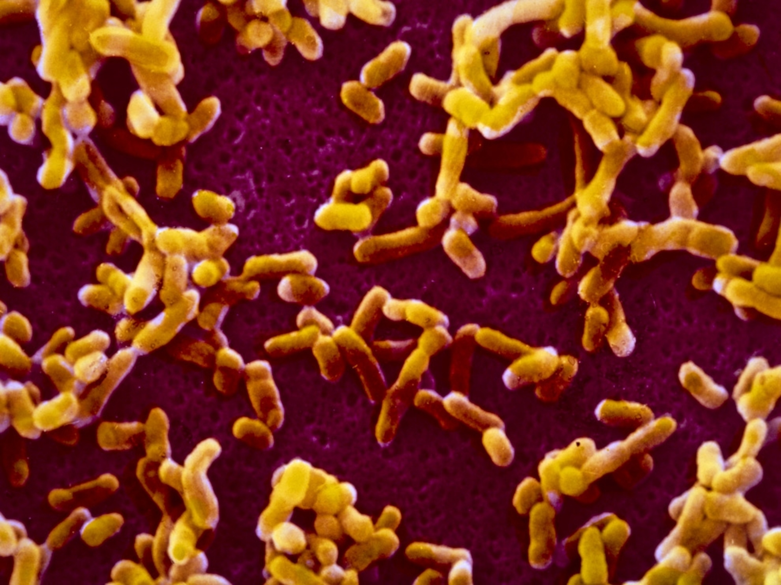 Microscopic view of plague bacteria