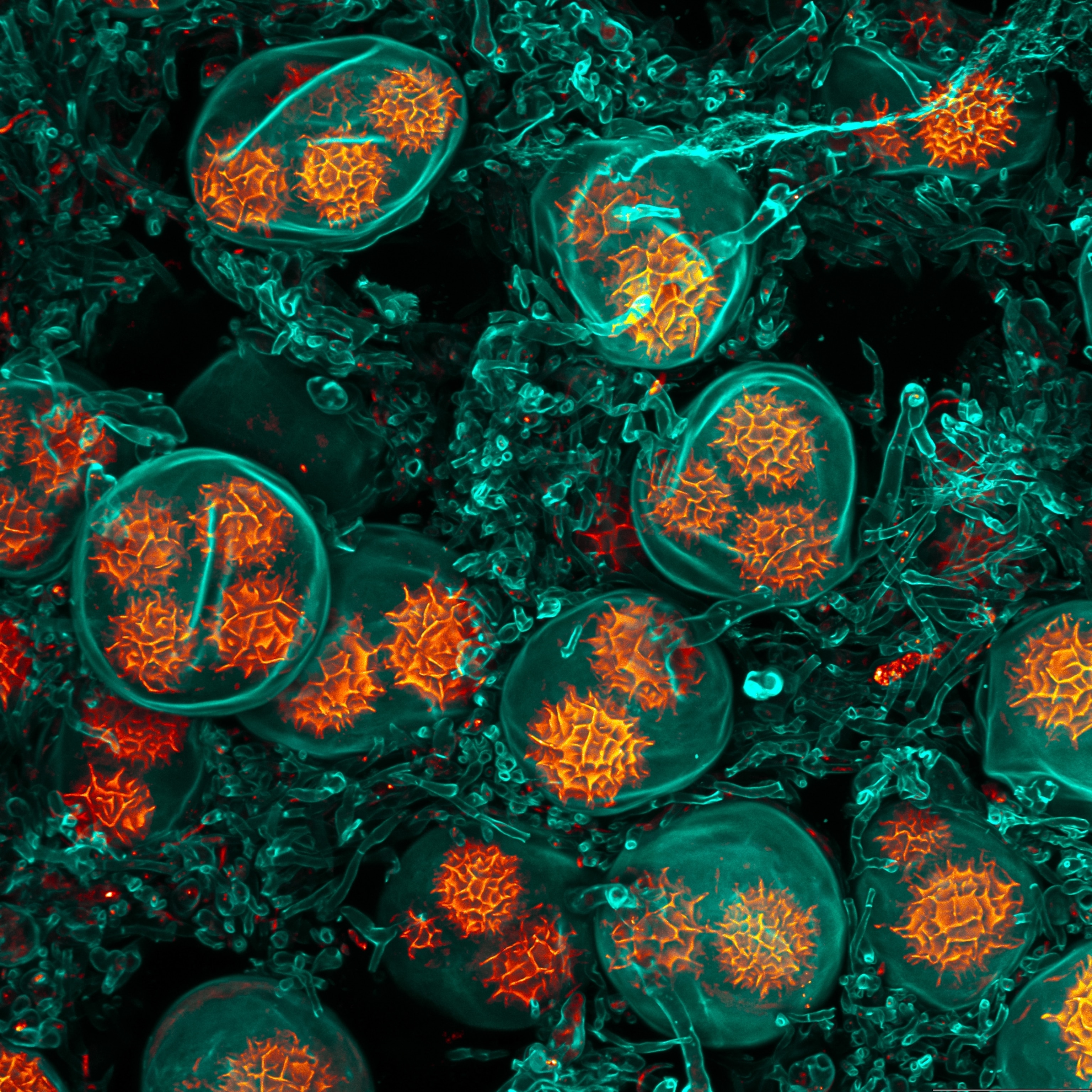 Jagged, orange balls, similar to grains of pollen, wrapped in translucent green vesicles.