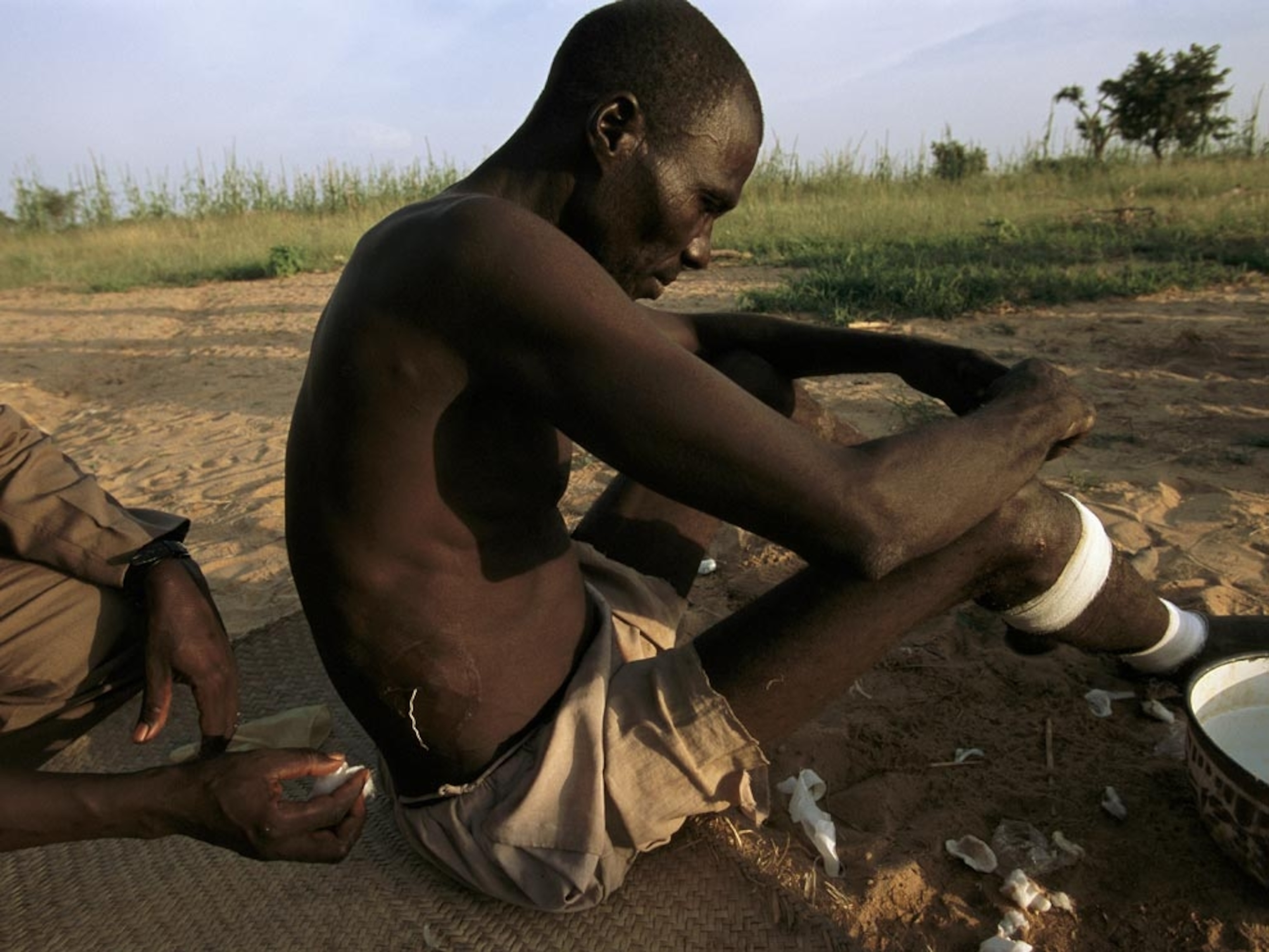 A Niger farmer being treated for guinea worm disease
