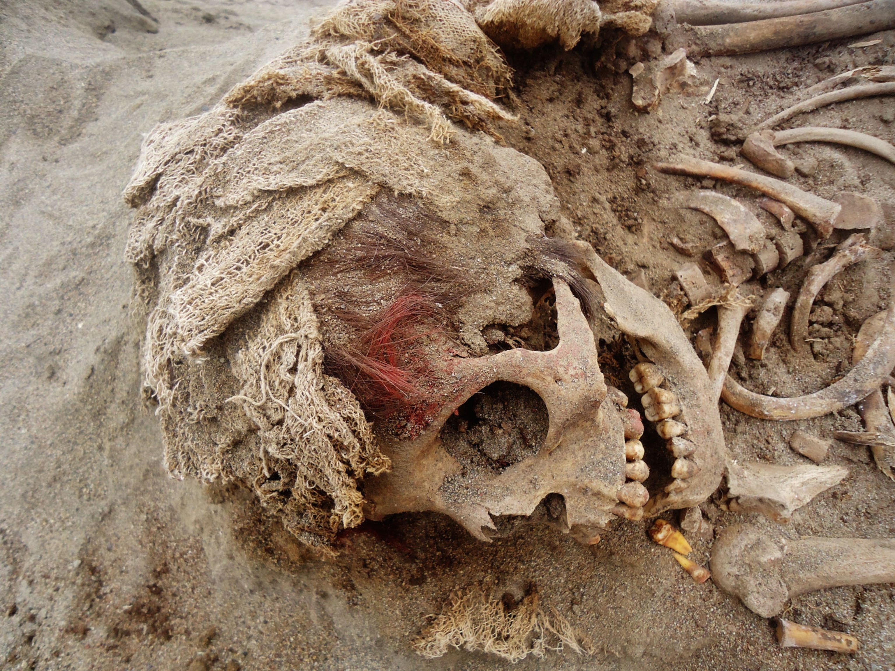skull of a child with hear stained red.