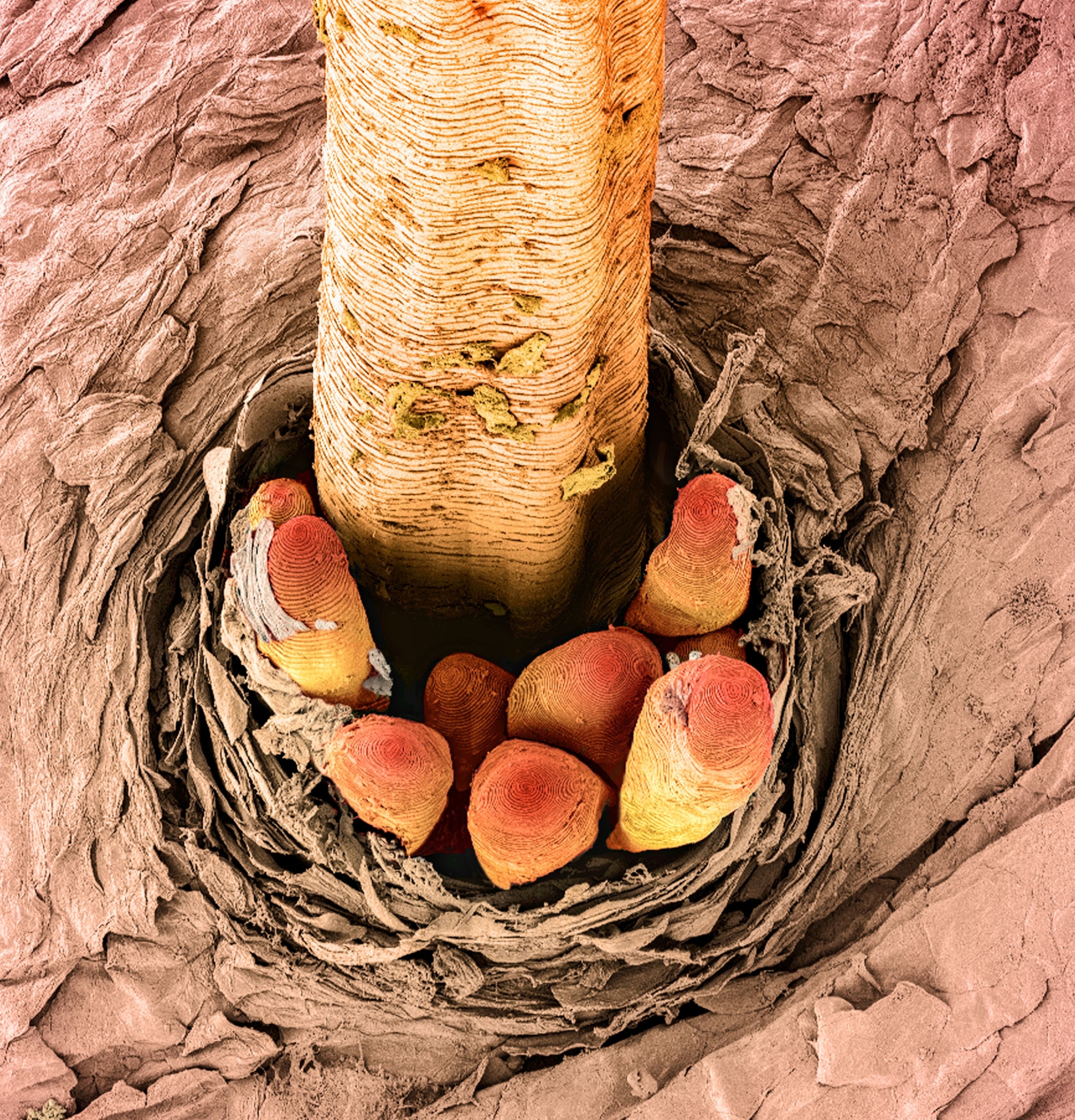 mites eggs nesting by the rote of hair.