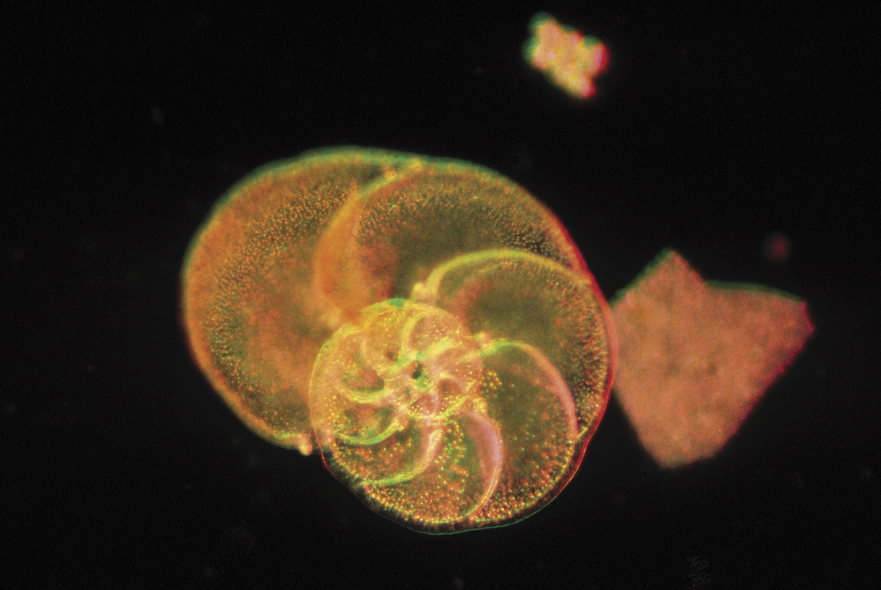 magnified image of a unicellular microorganism