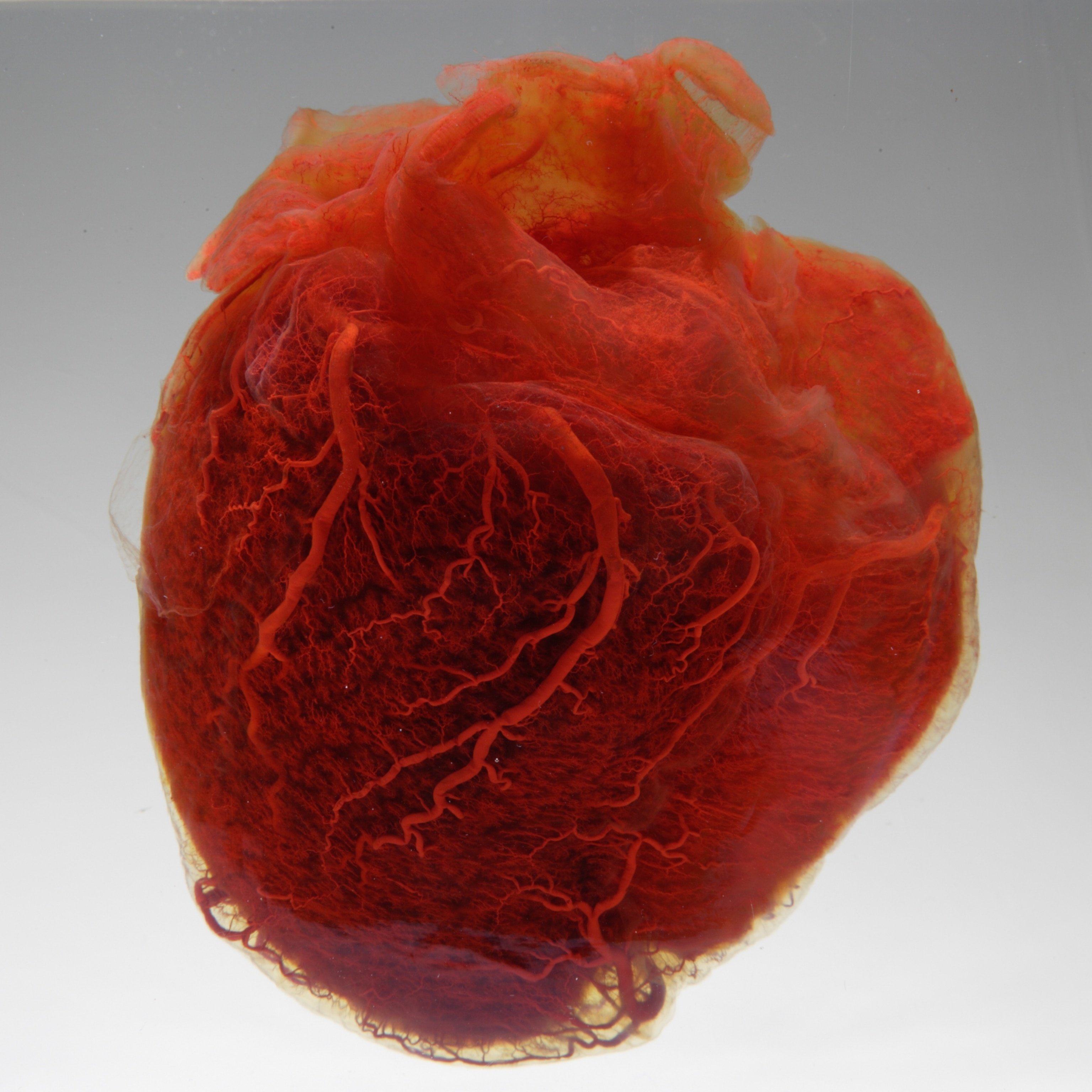 A human heart displayed with the fat stripped away.