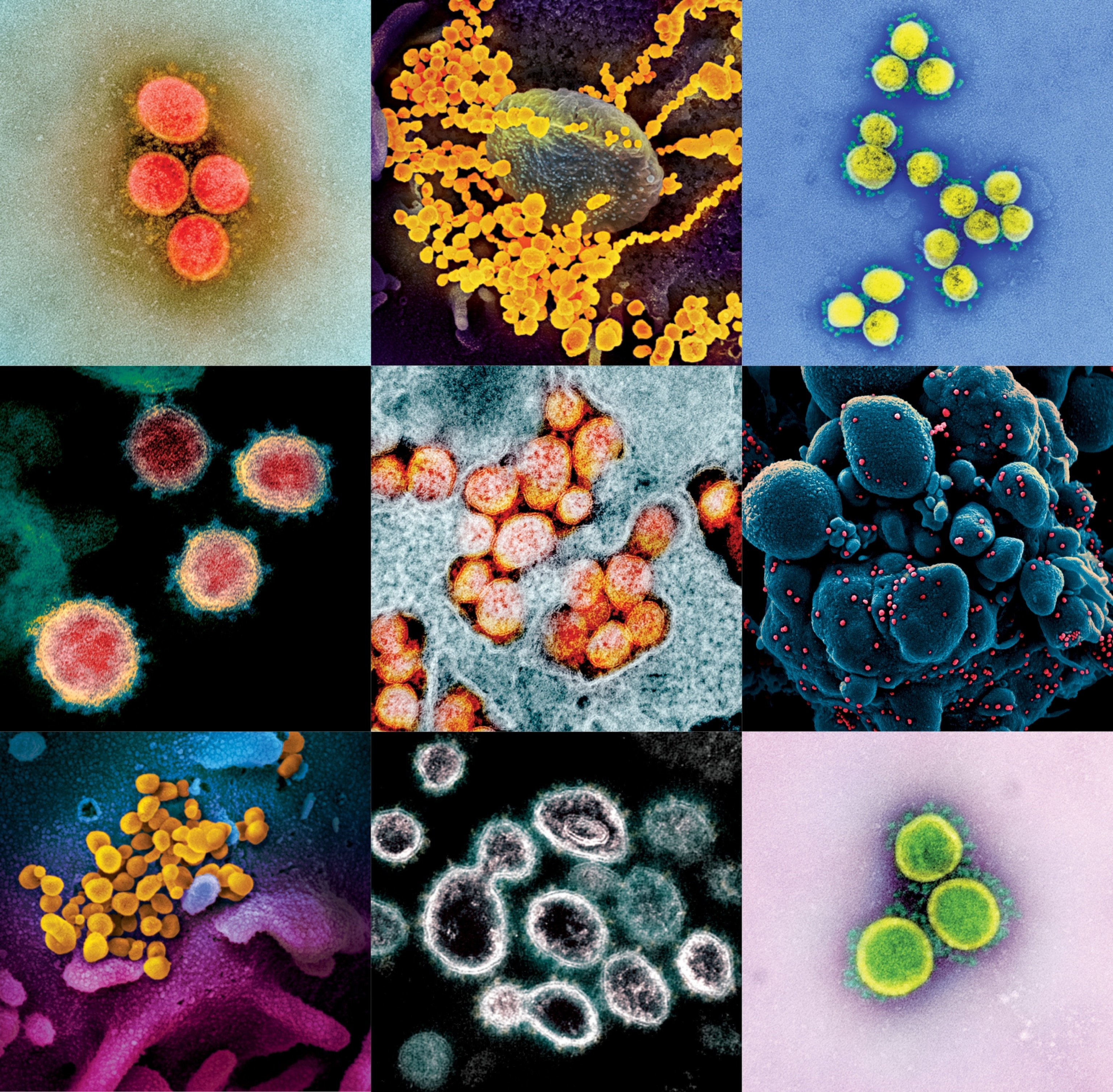 microscopic photo of virus.