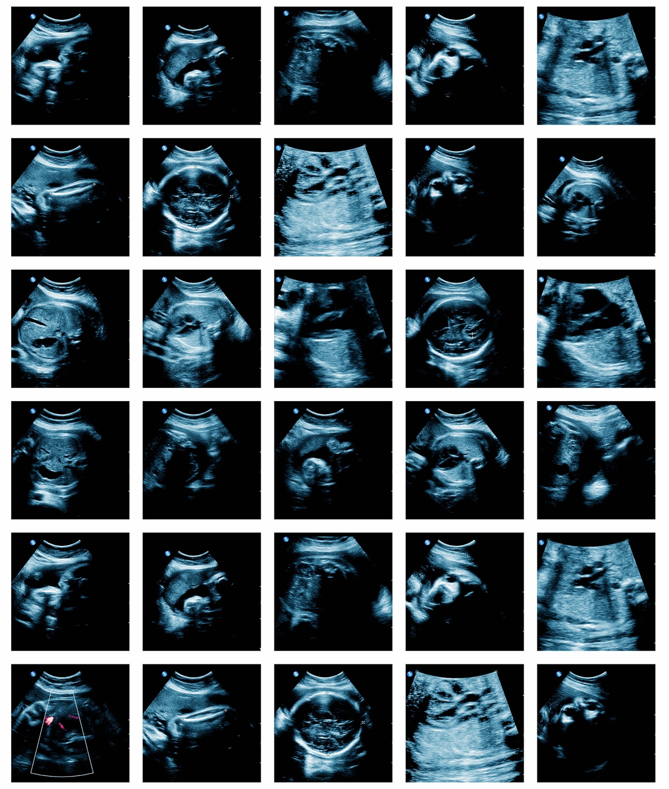 A grid of images of fetuses in the womb.