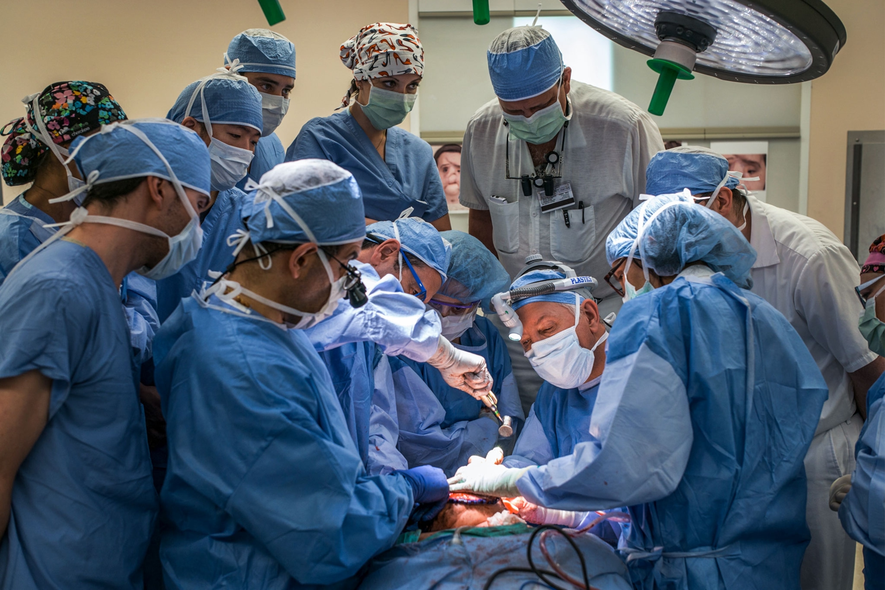 a group of surgeons performing a face transplant