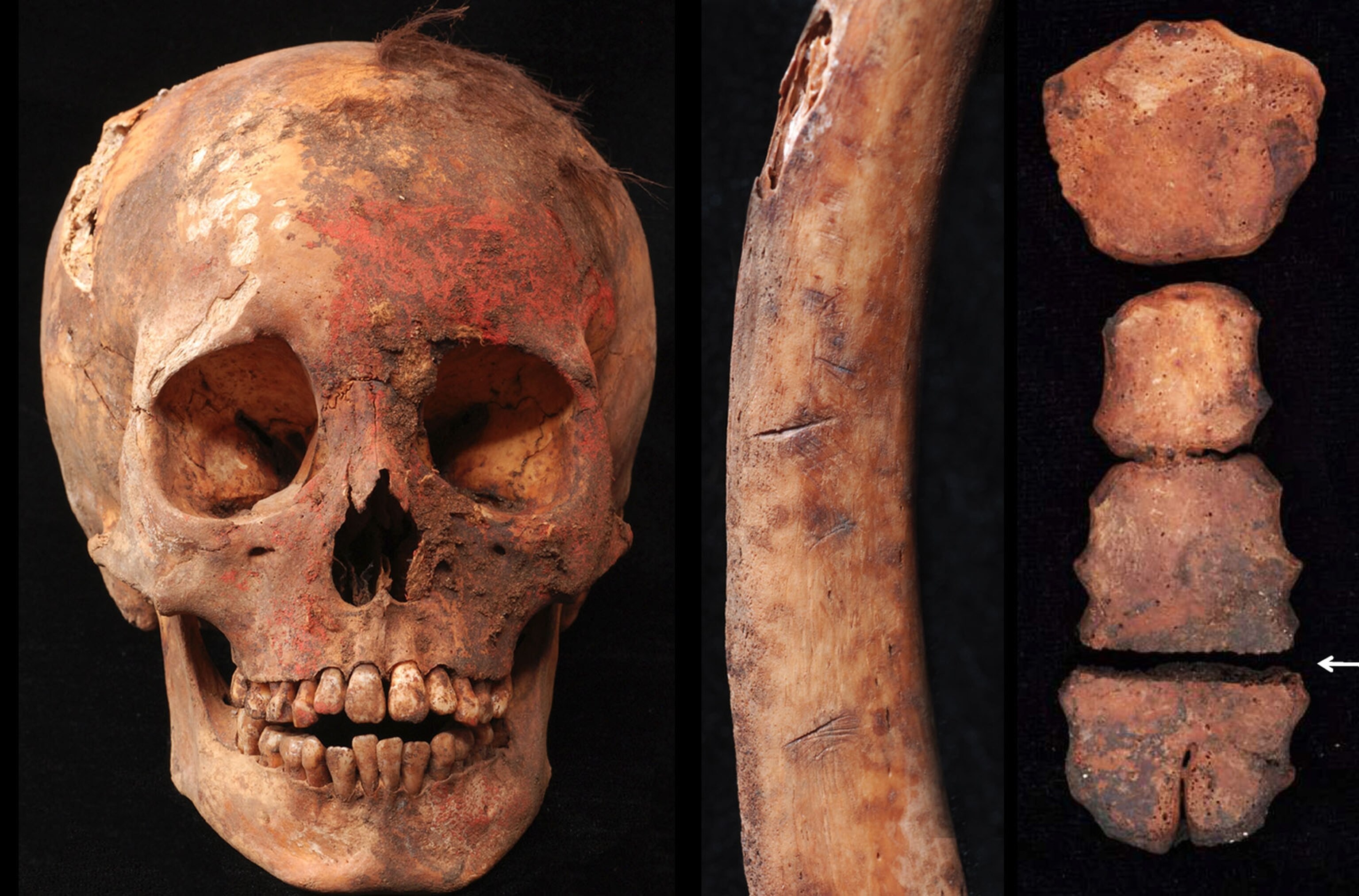 skull stained with a red cinnabar-based pigment, cut human rib bone and a sternum.