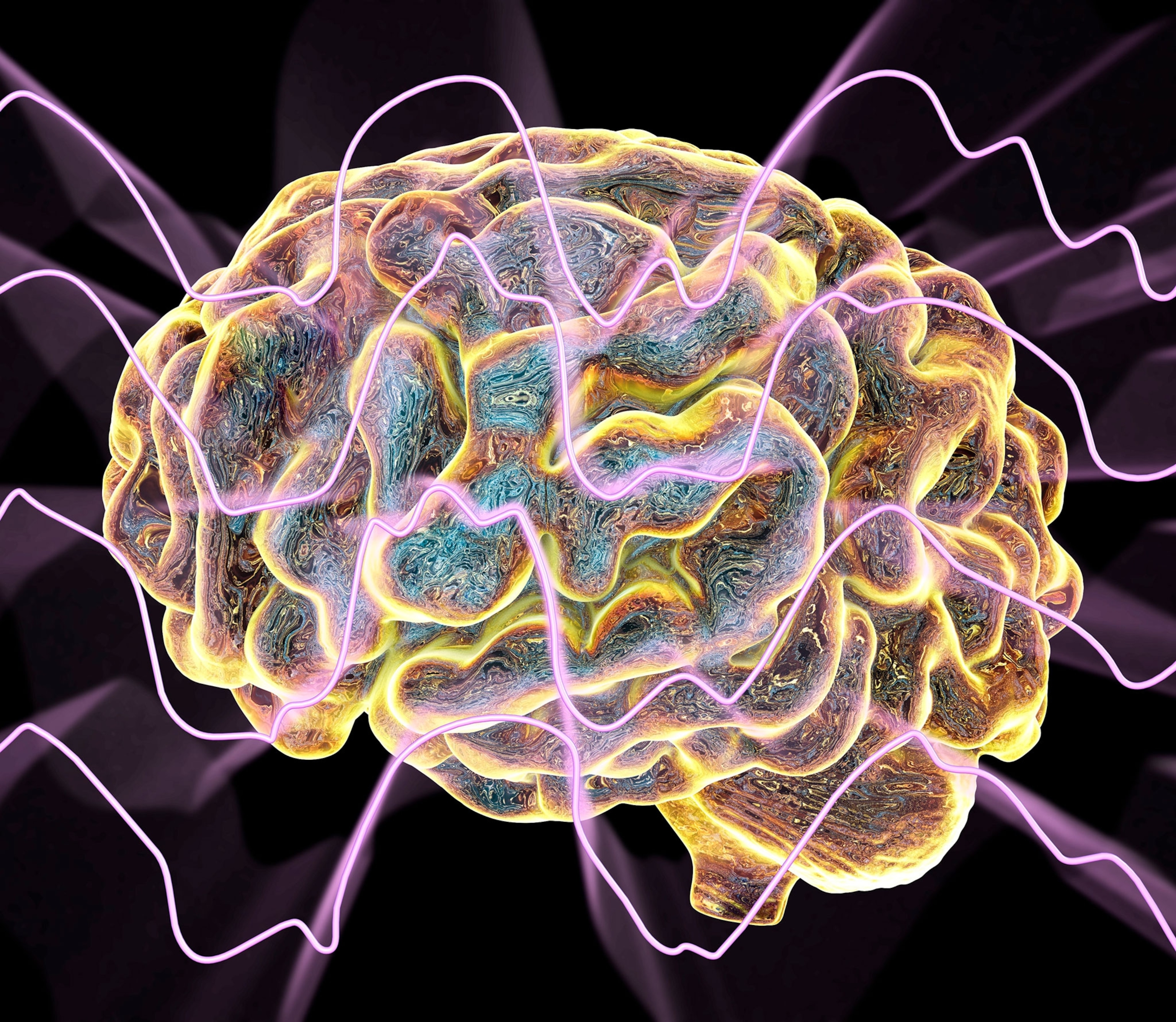 A brain, outlined in yellow with a kaleidoscope of colors with purple, electric, squiggly lines.