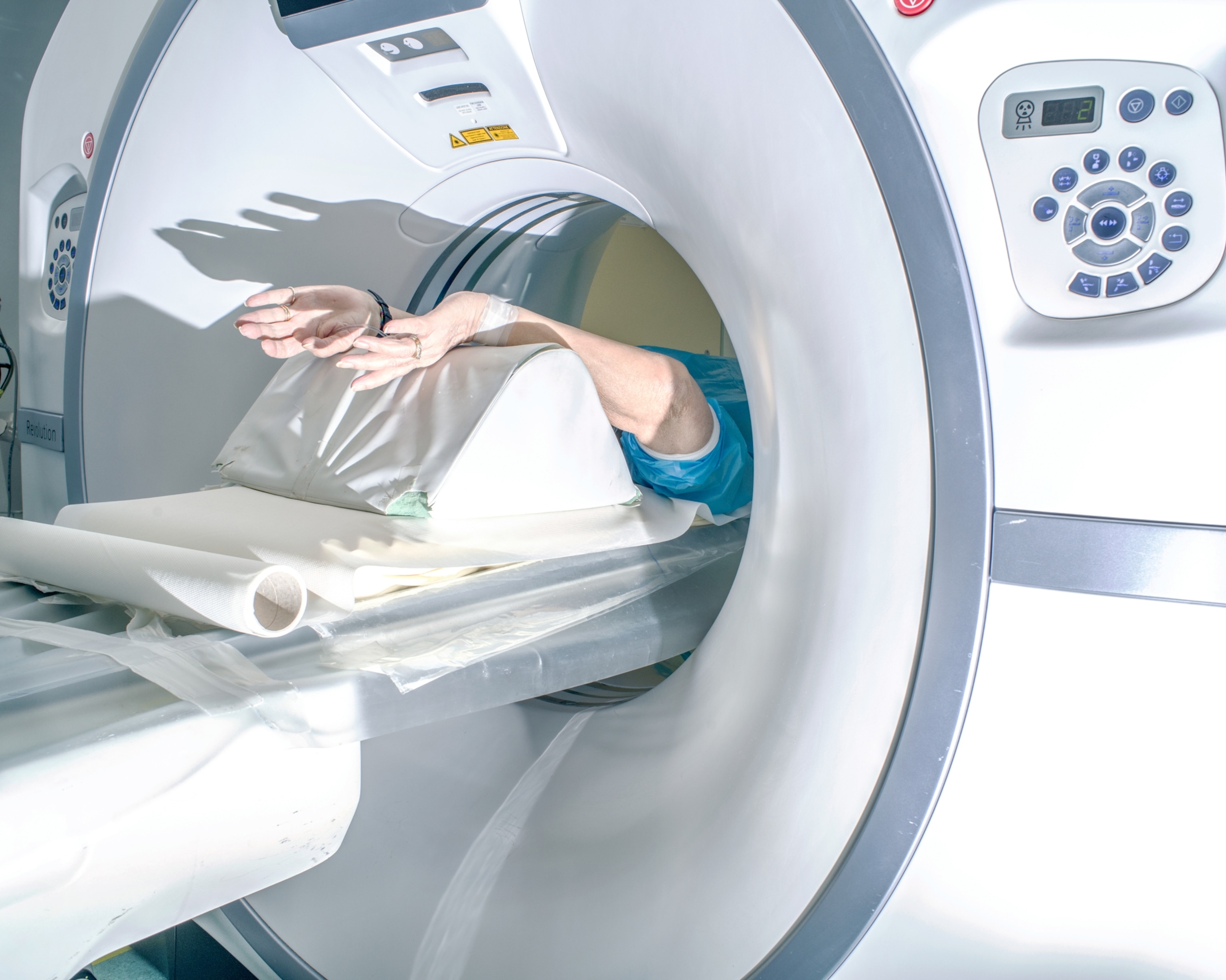 Picture of a patient's arms sticking out from a CT scanner.