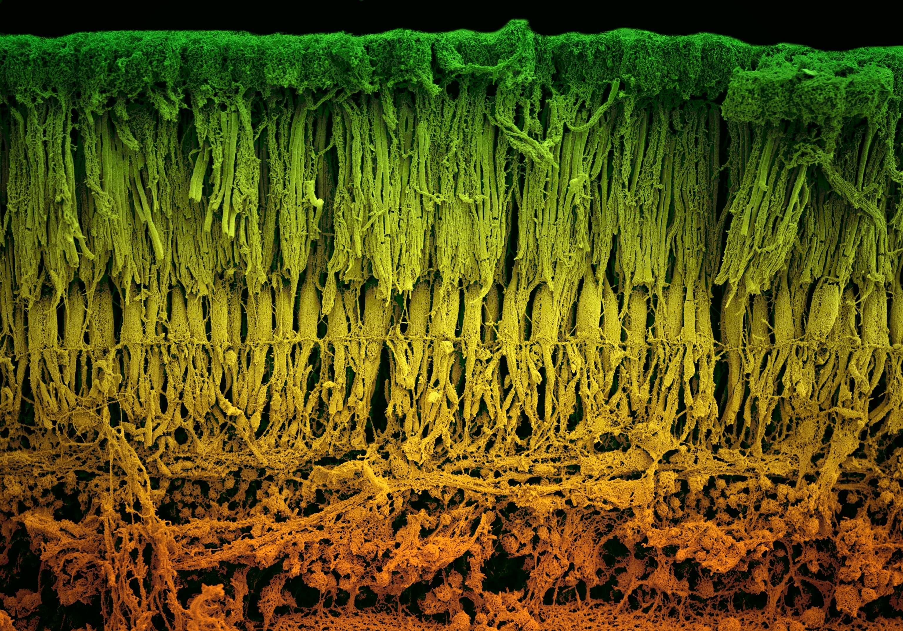 A multicolored image of a scanning electron micrograph depicting a magnified cross-section view of a healthy retina of a human eye.