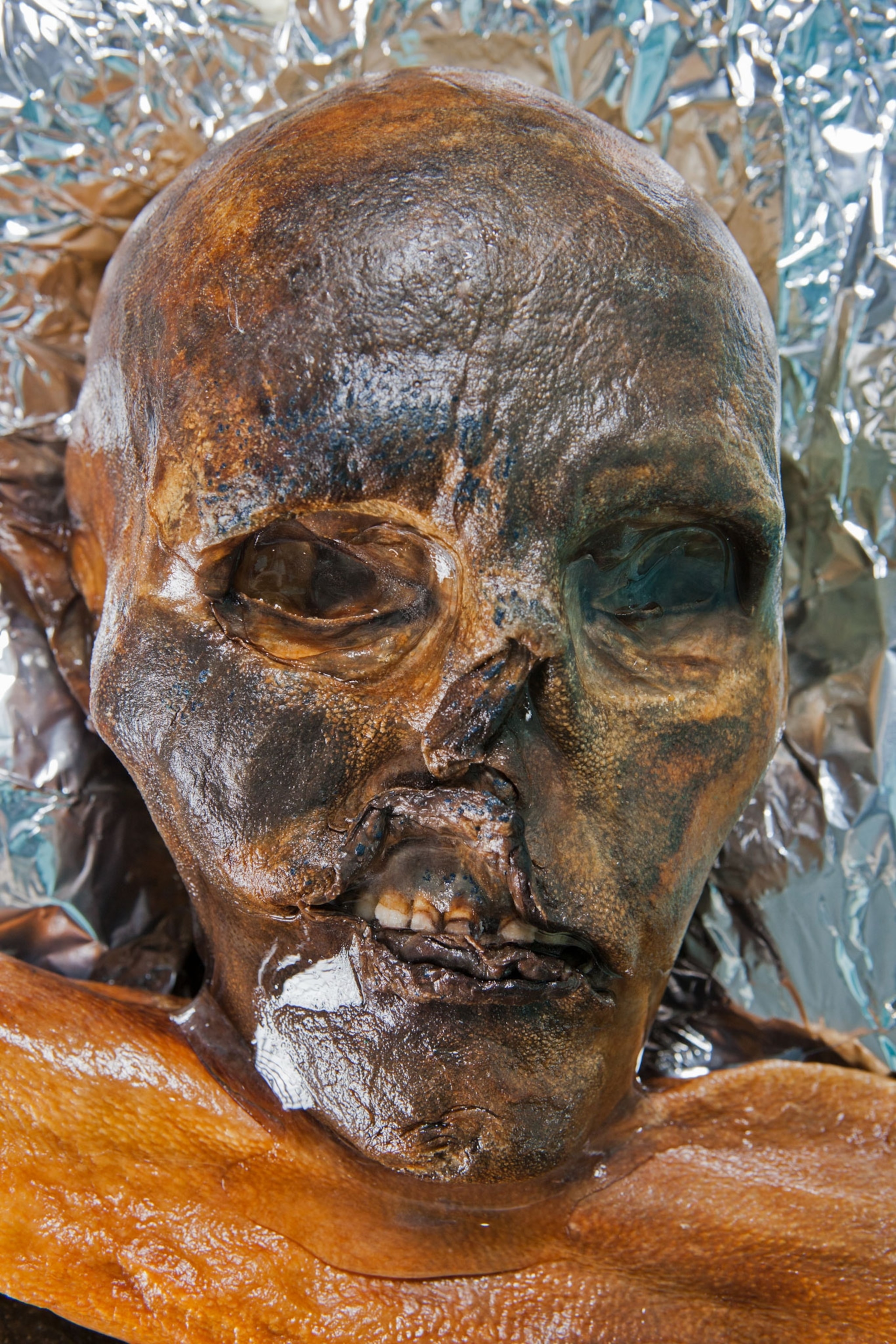 Scientists performing an autopsy on Otzi the Iceman