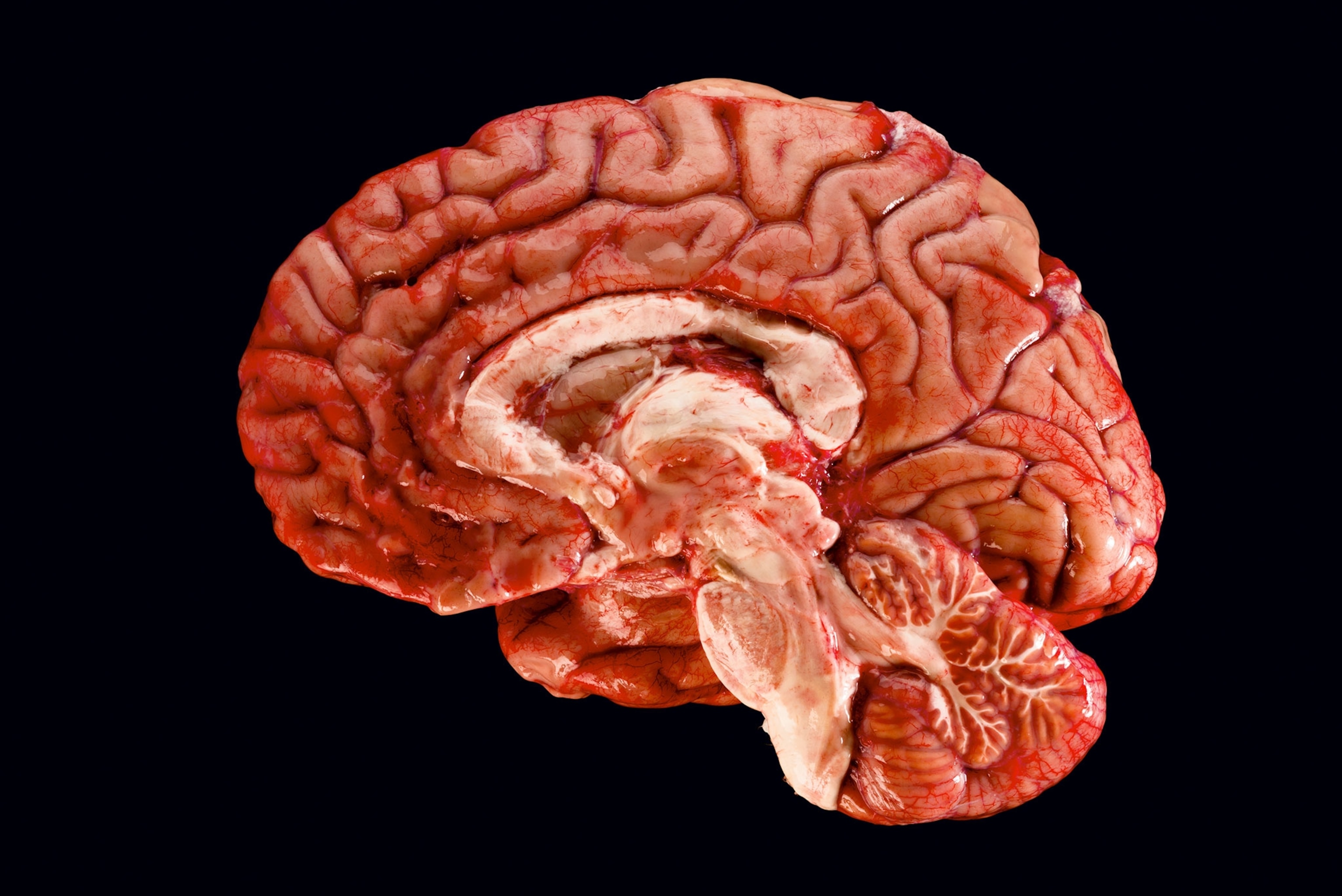 brain