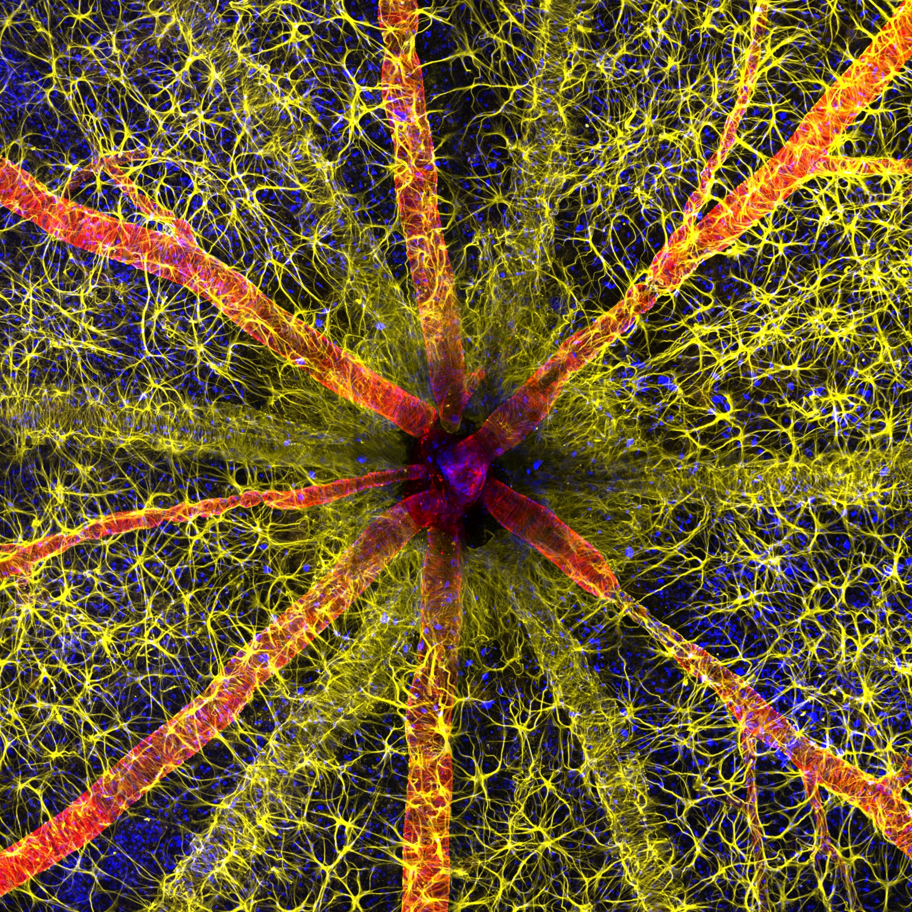 A rodent optic nerve head, showing red contractile proteins covered in yellow astrocytes, converging to a central point.