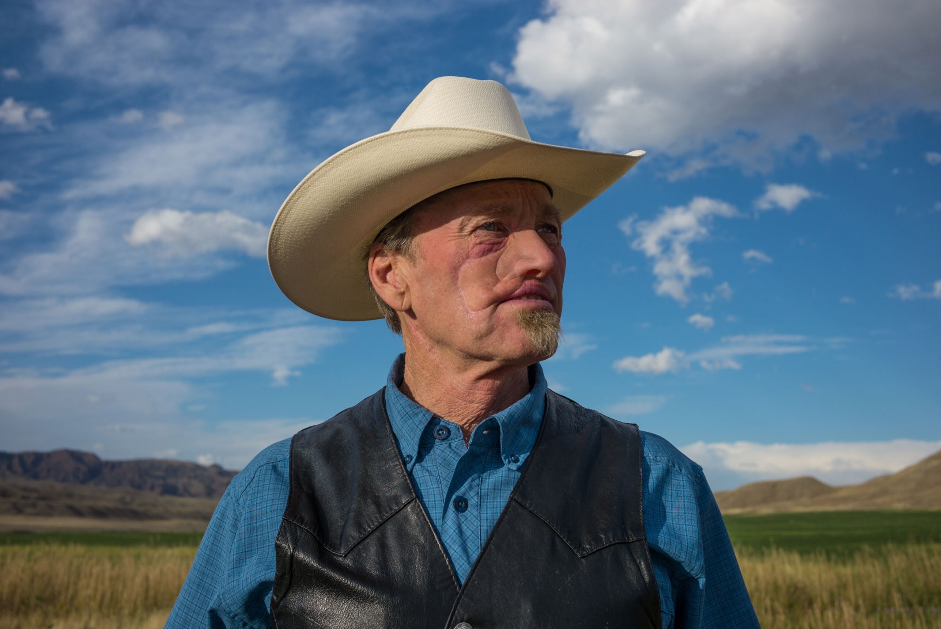 Nic Patrick, who was mauled by a grizzly
