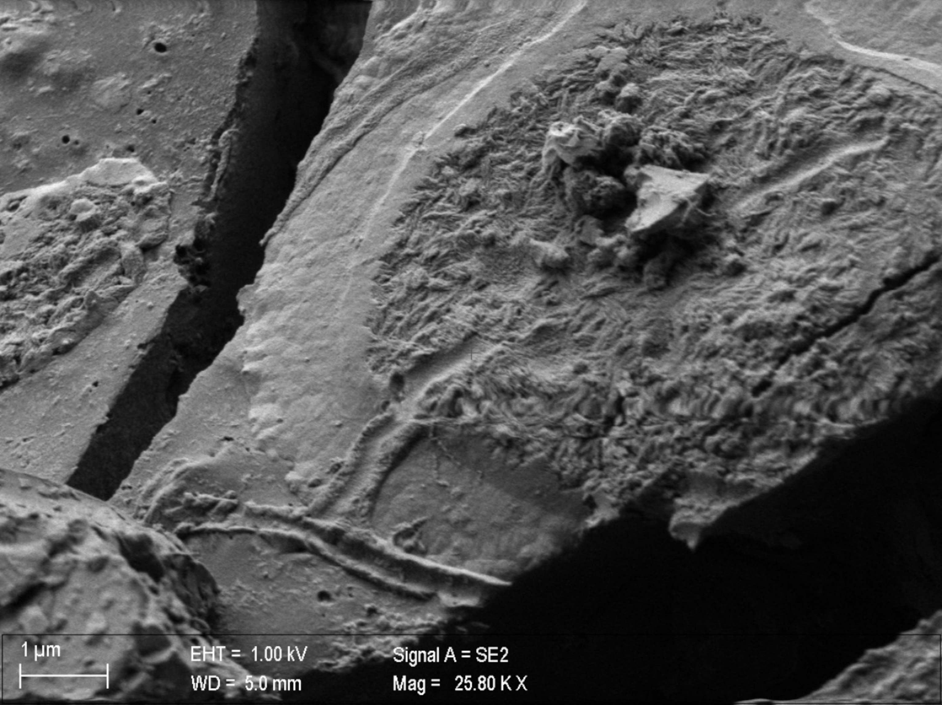 A micrographic view of the surface of a rock-like brain fragment, where an imprint of tube-like branching structures is revealed