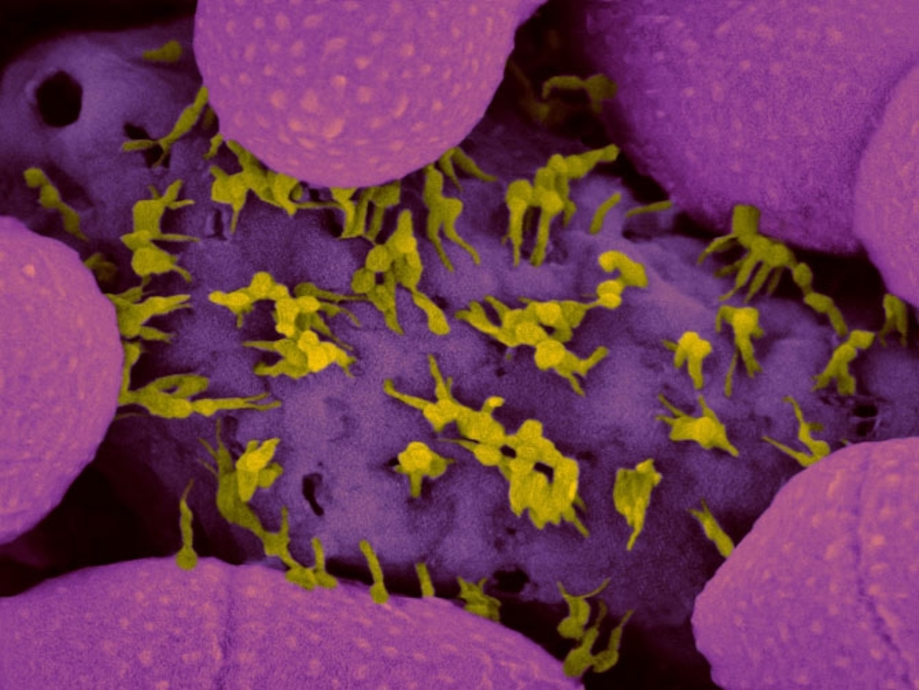 Bacteriophages