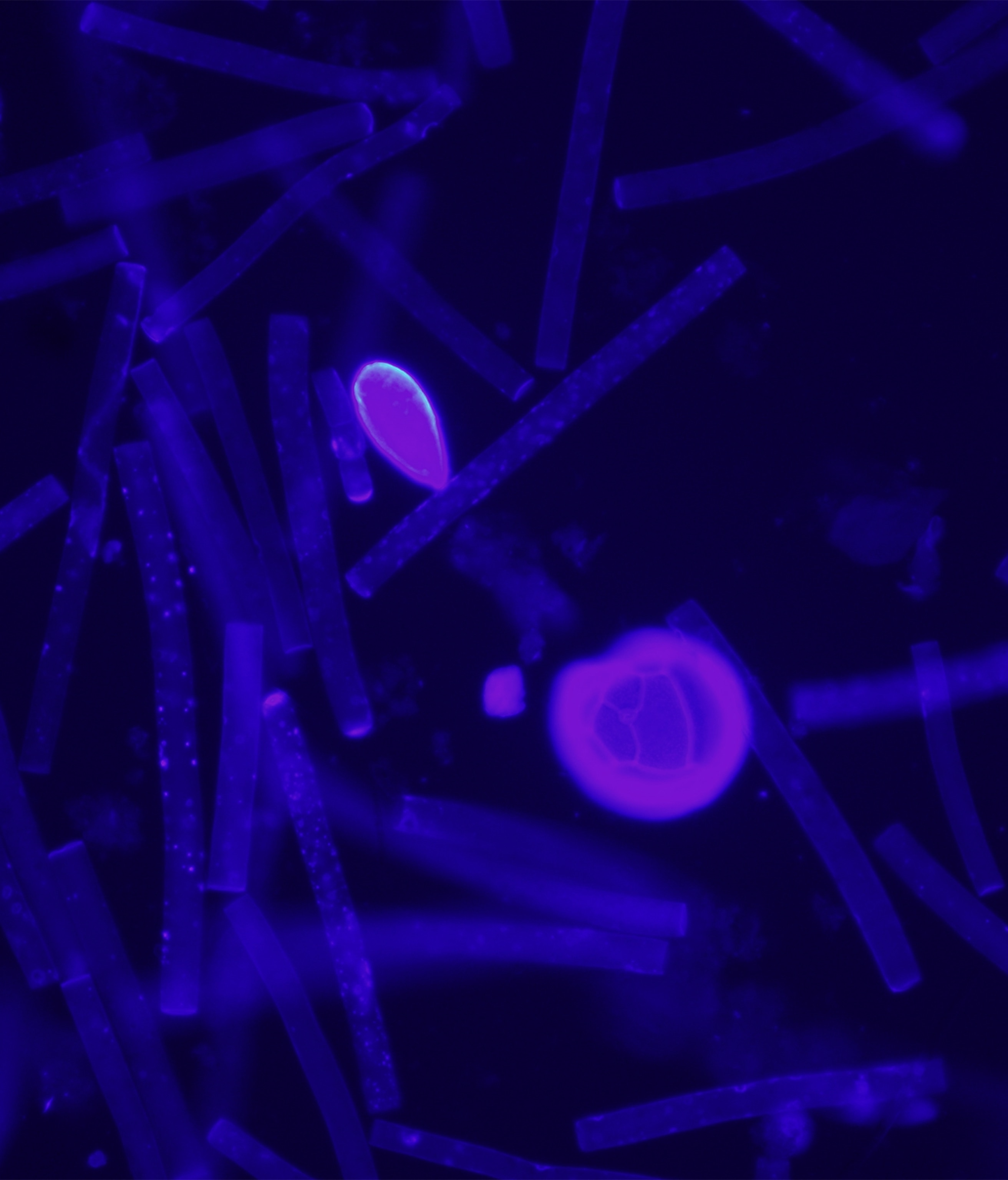 An image with purple spherical shapes on a black background.