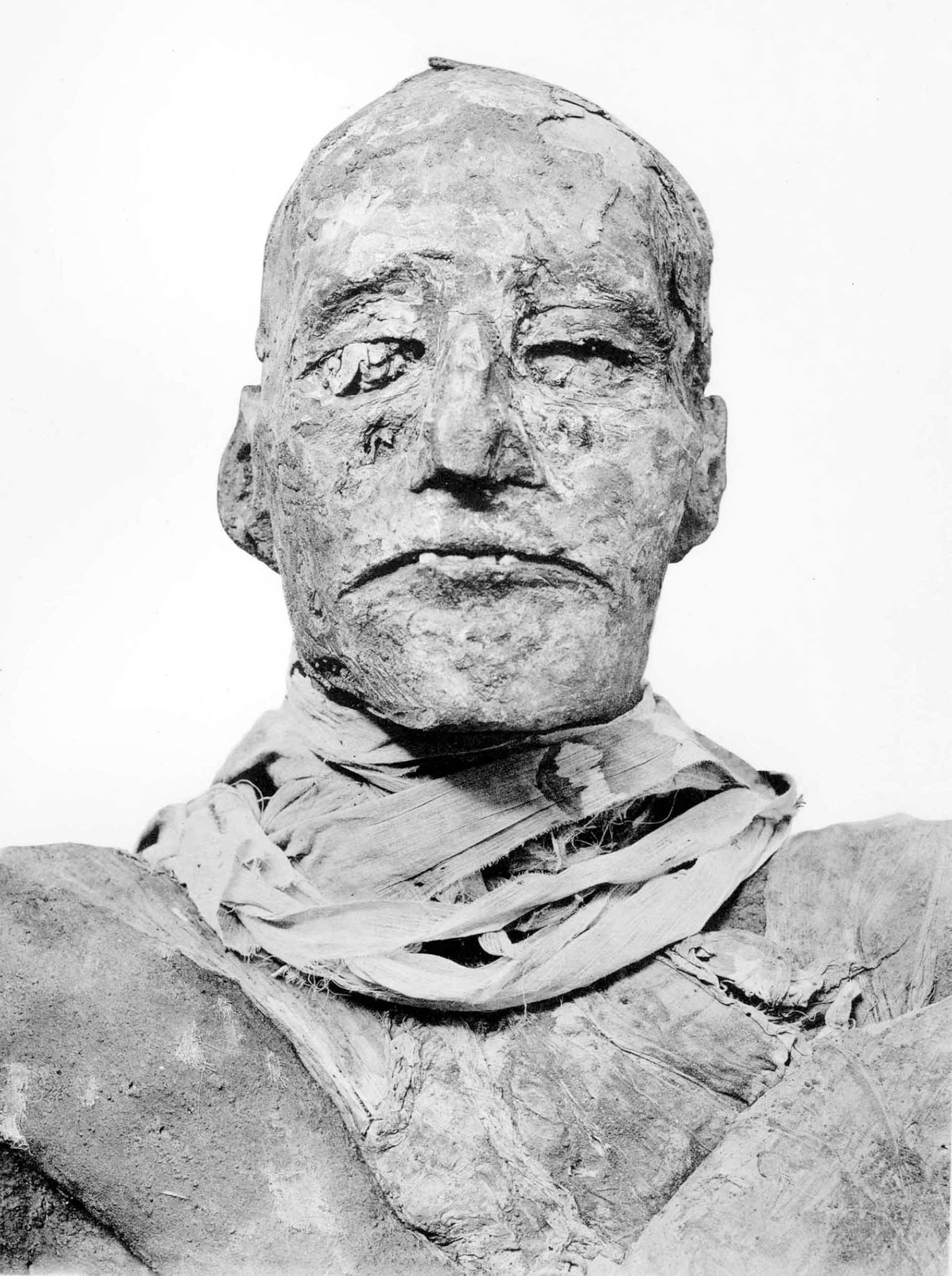 A black and white photograph of Ramses the third's mummy head, neck, and chest from the Twentieth Dynasty of Egypt shows linen loosely wrapped around his neck.