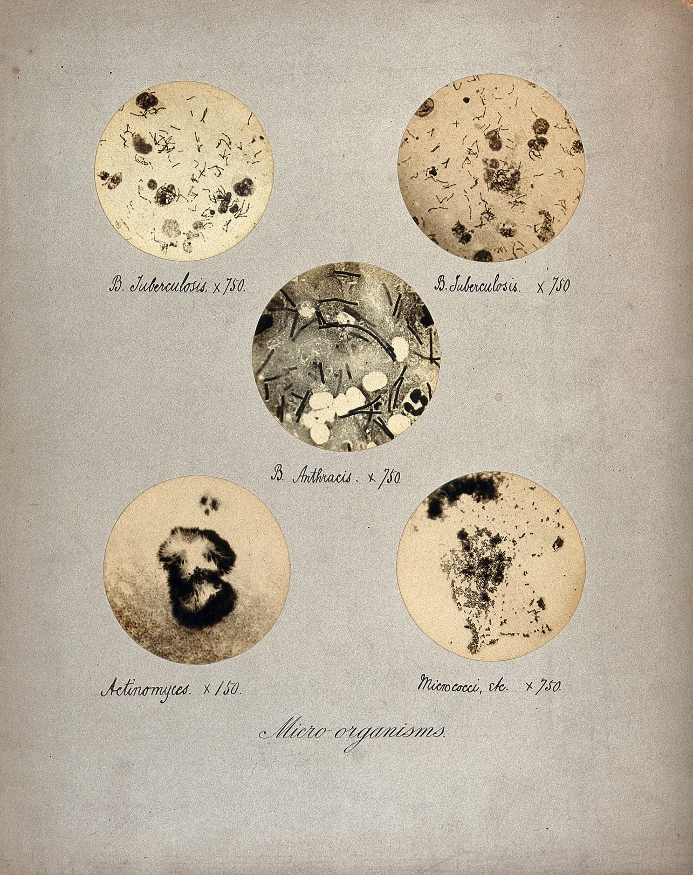 a book page with five round photos.