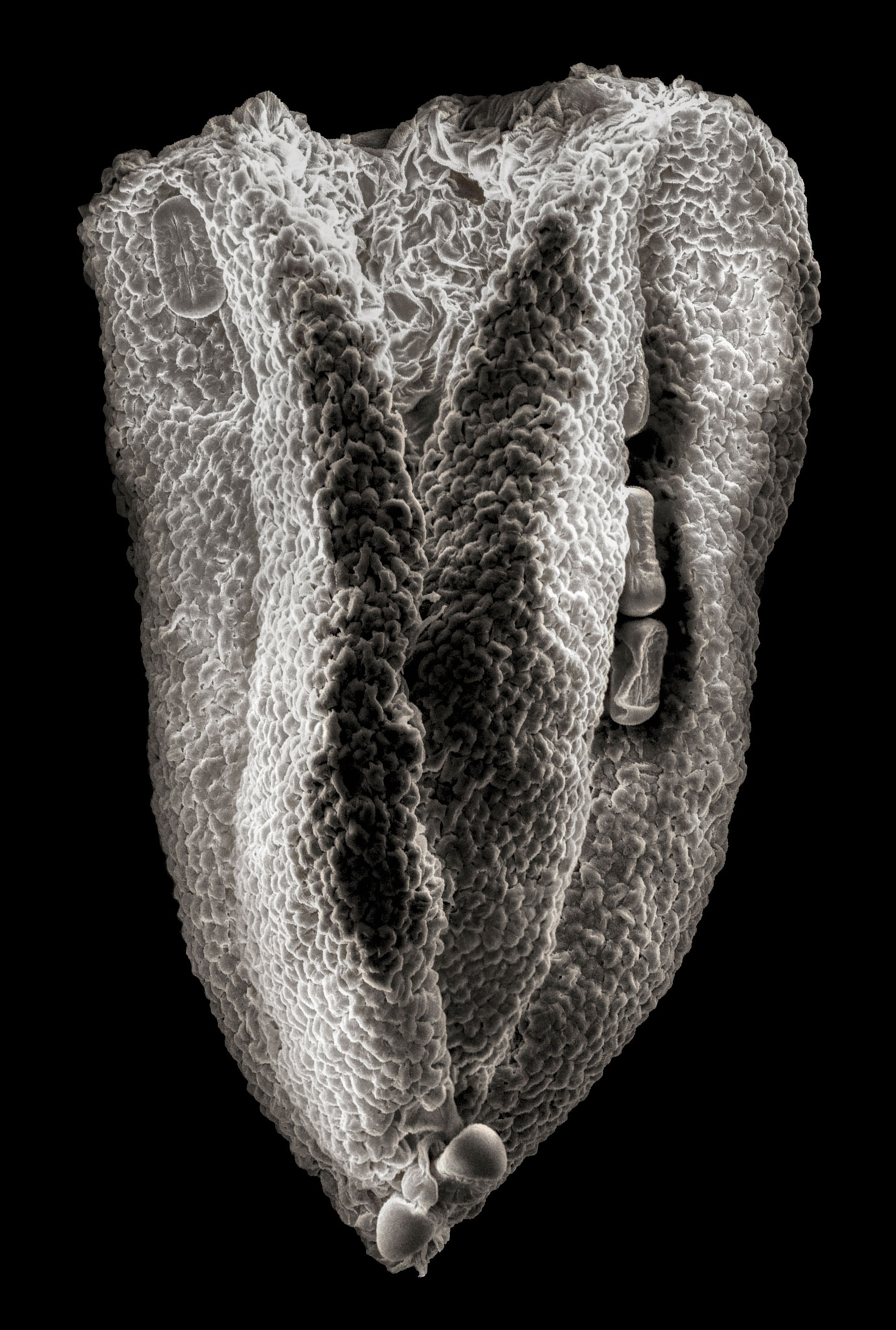 SEM of a fava bean