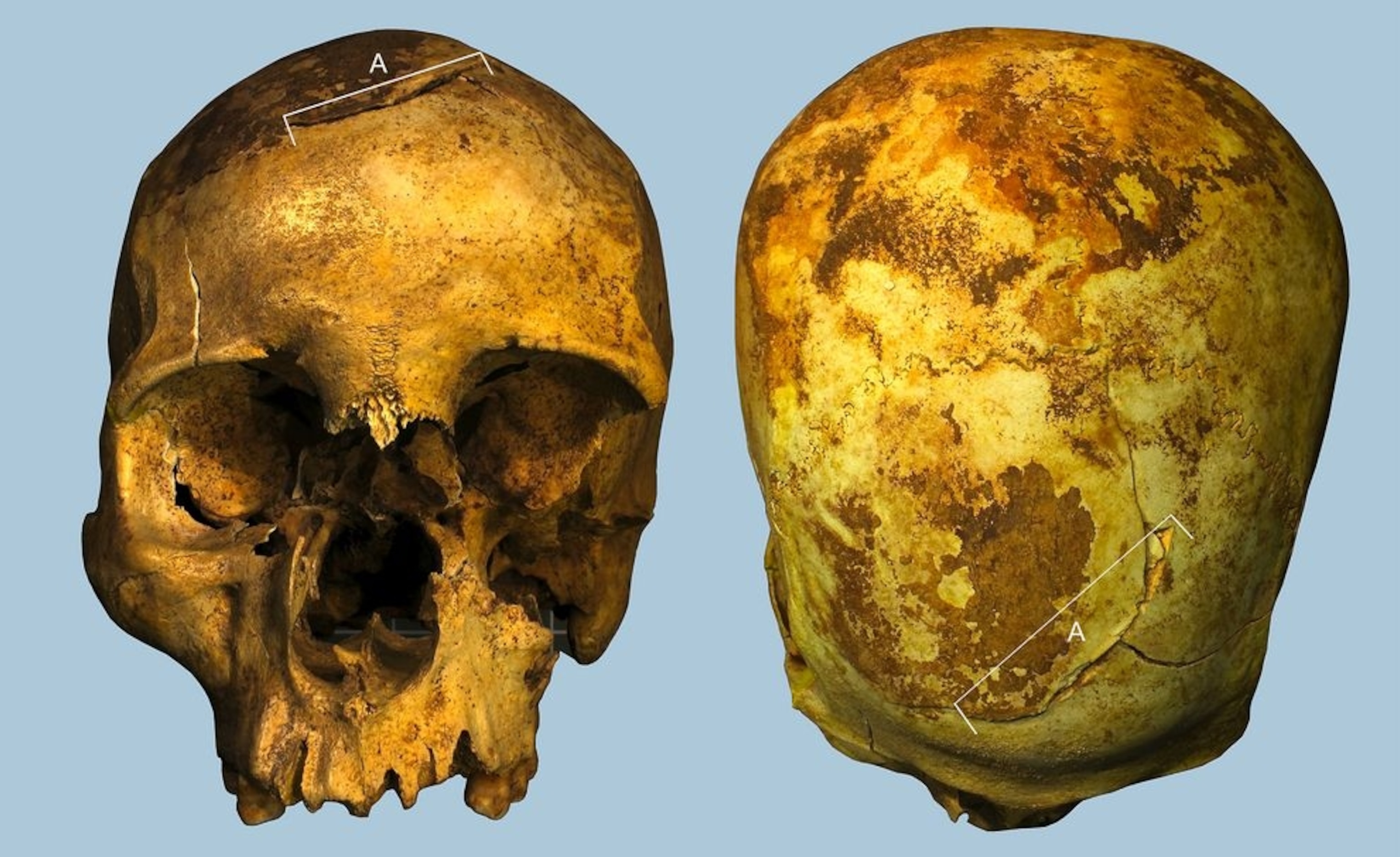 Pharaoh’s front and back of his skull