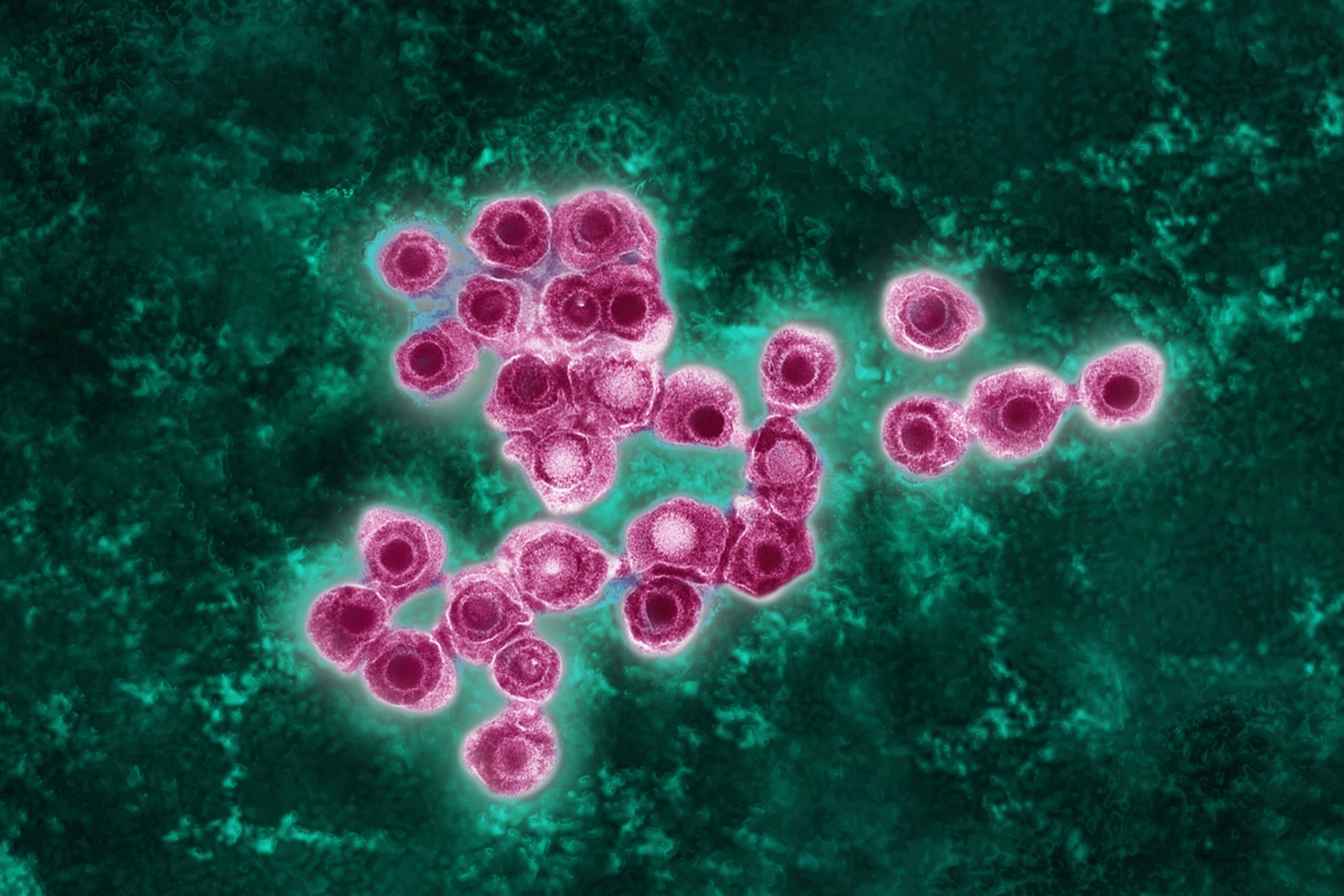 Colorized transmission electron microscopy showing Human Herpes Virus type 3, which appear as purple viral spheres surrounded by multi-lobed capsules.