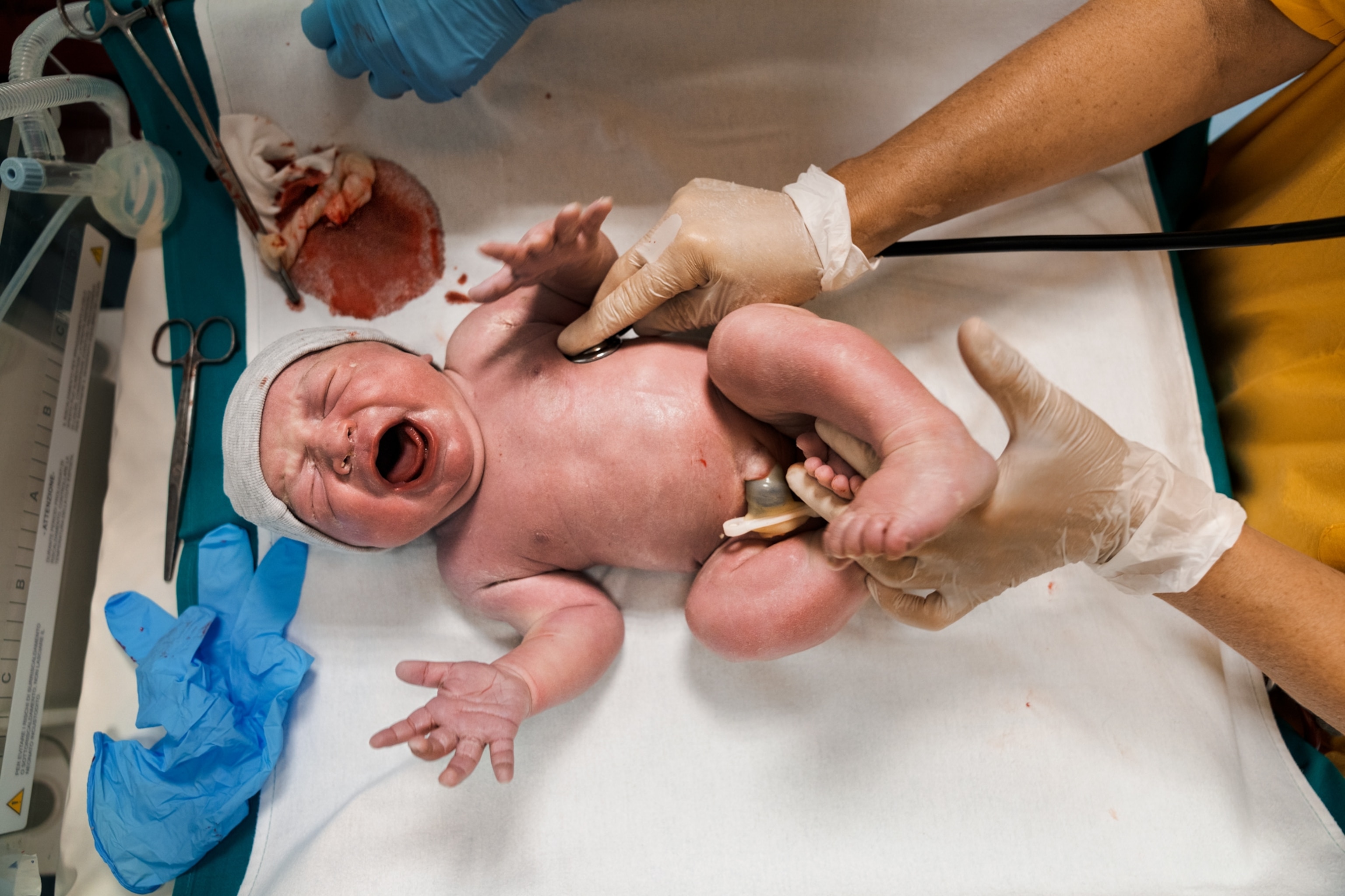 Picture of new-born baby