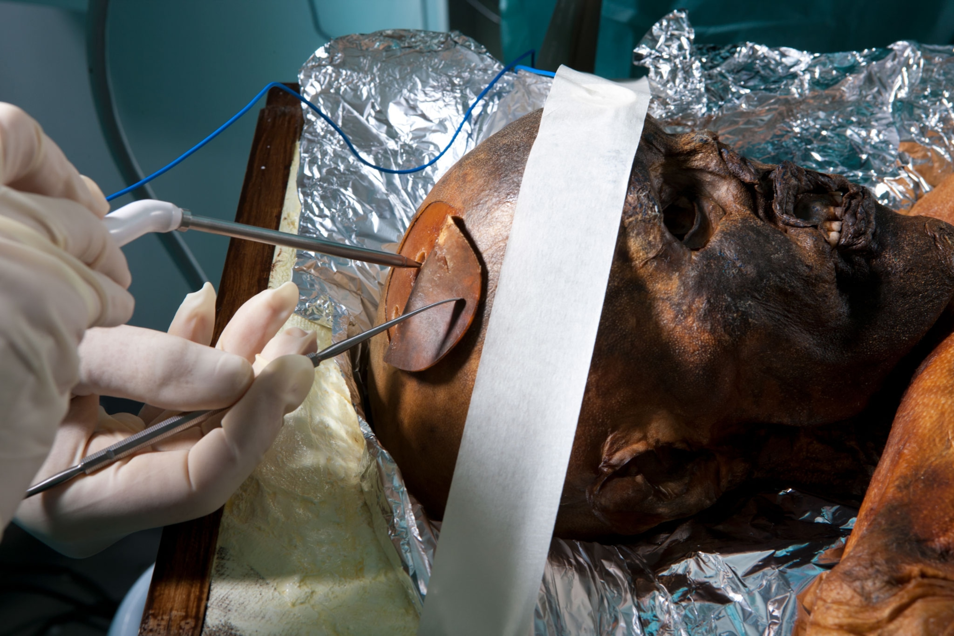 Scientists performing an autopsy on Otzi the Iceman