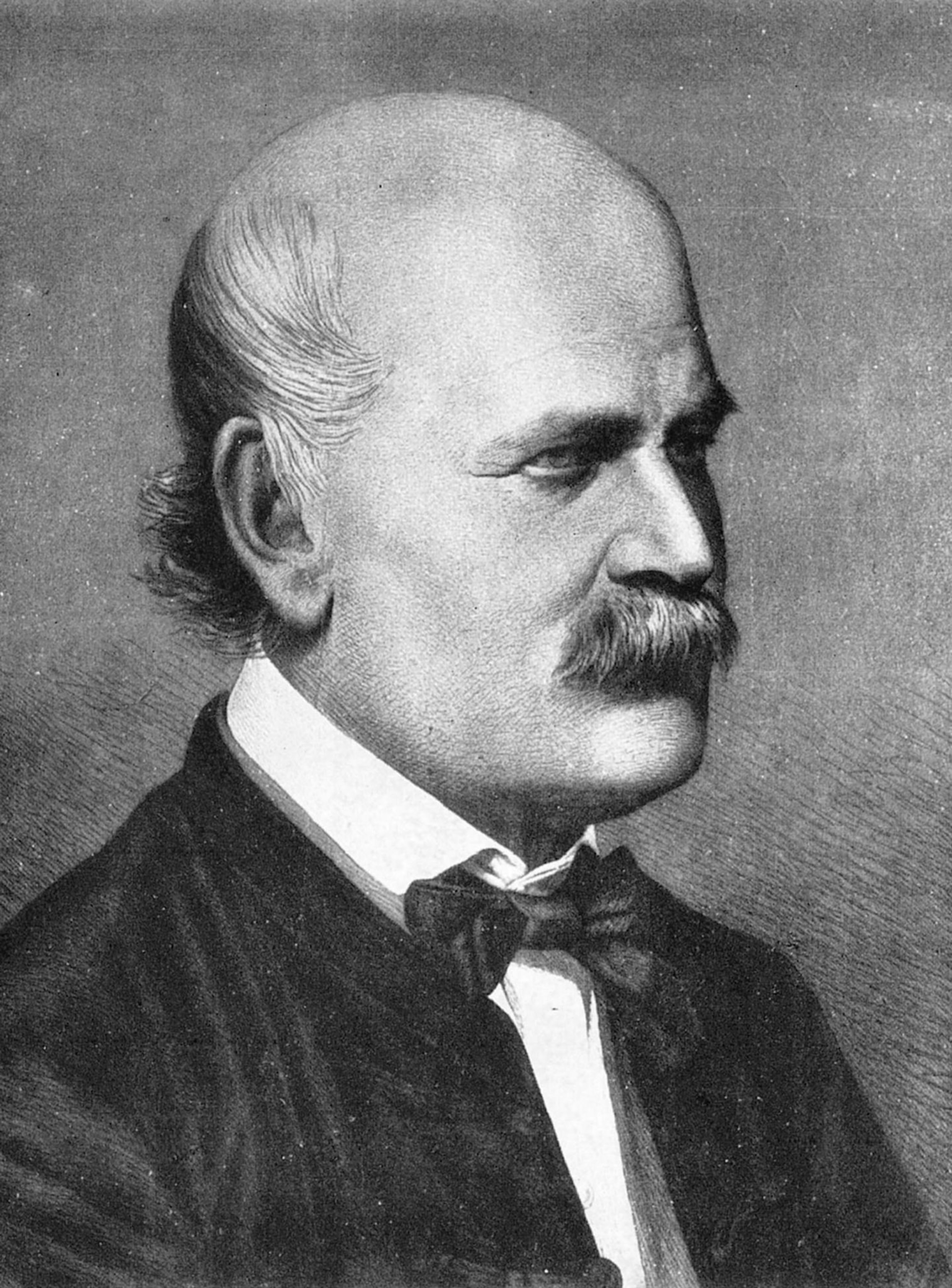 A black and white profile portrait of Ignaz Philipp Semmelweis