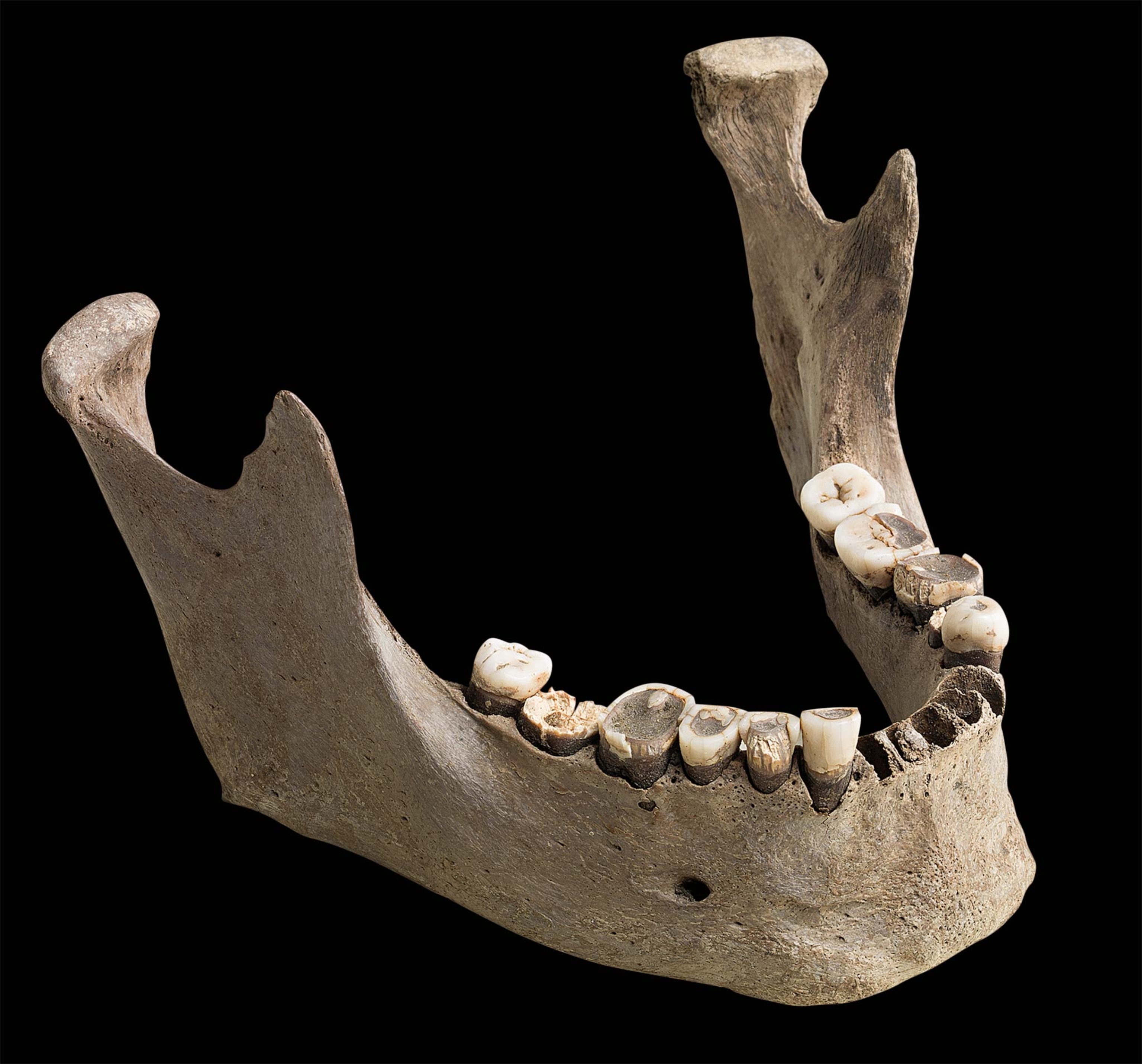 A jawbone with teeth in front of a black background