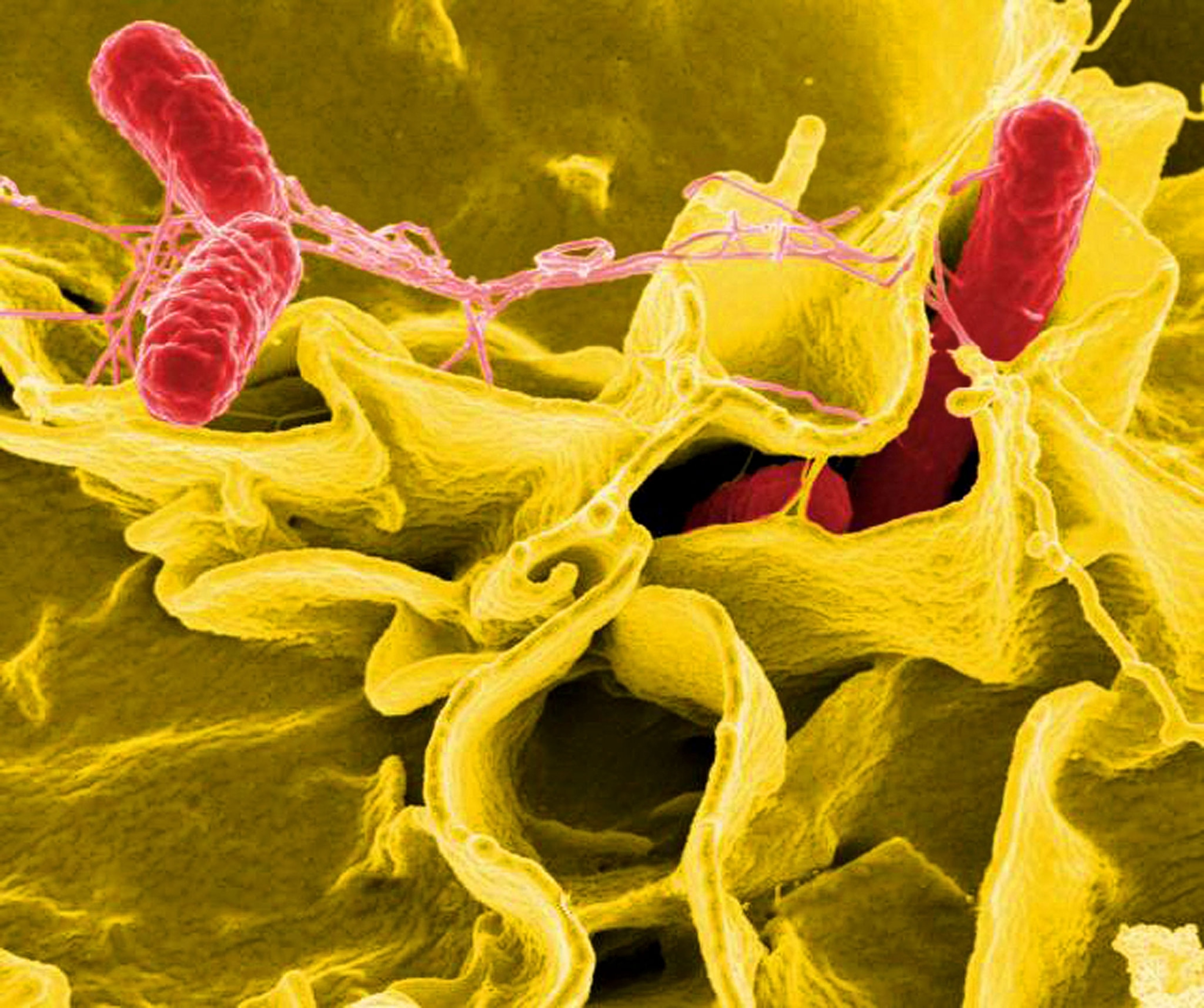 salmonella bacteria as seen under a microscope