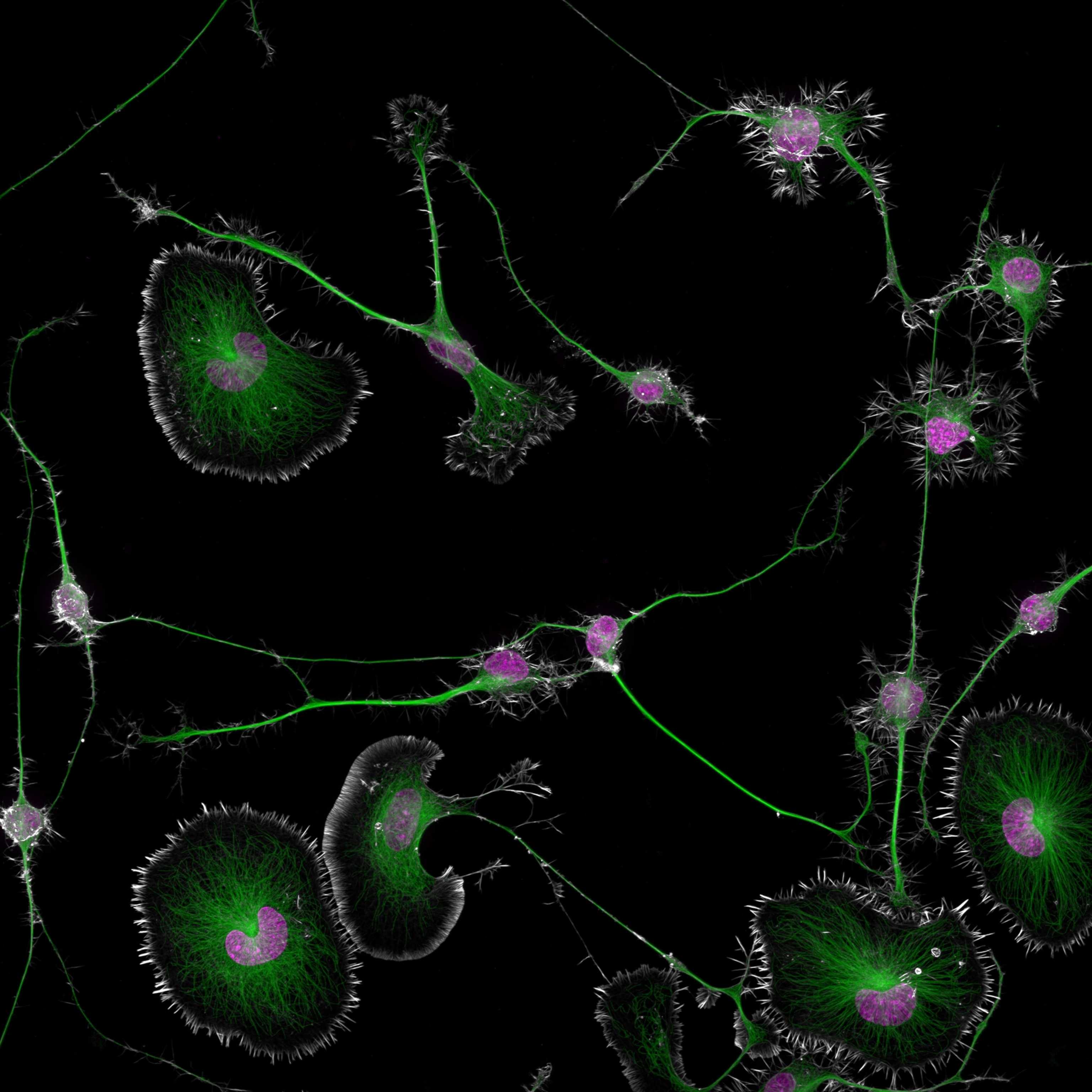 Irregularly shaped blobs, containing bright green-dyed filaments and purple-dyed nuclei.