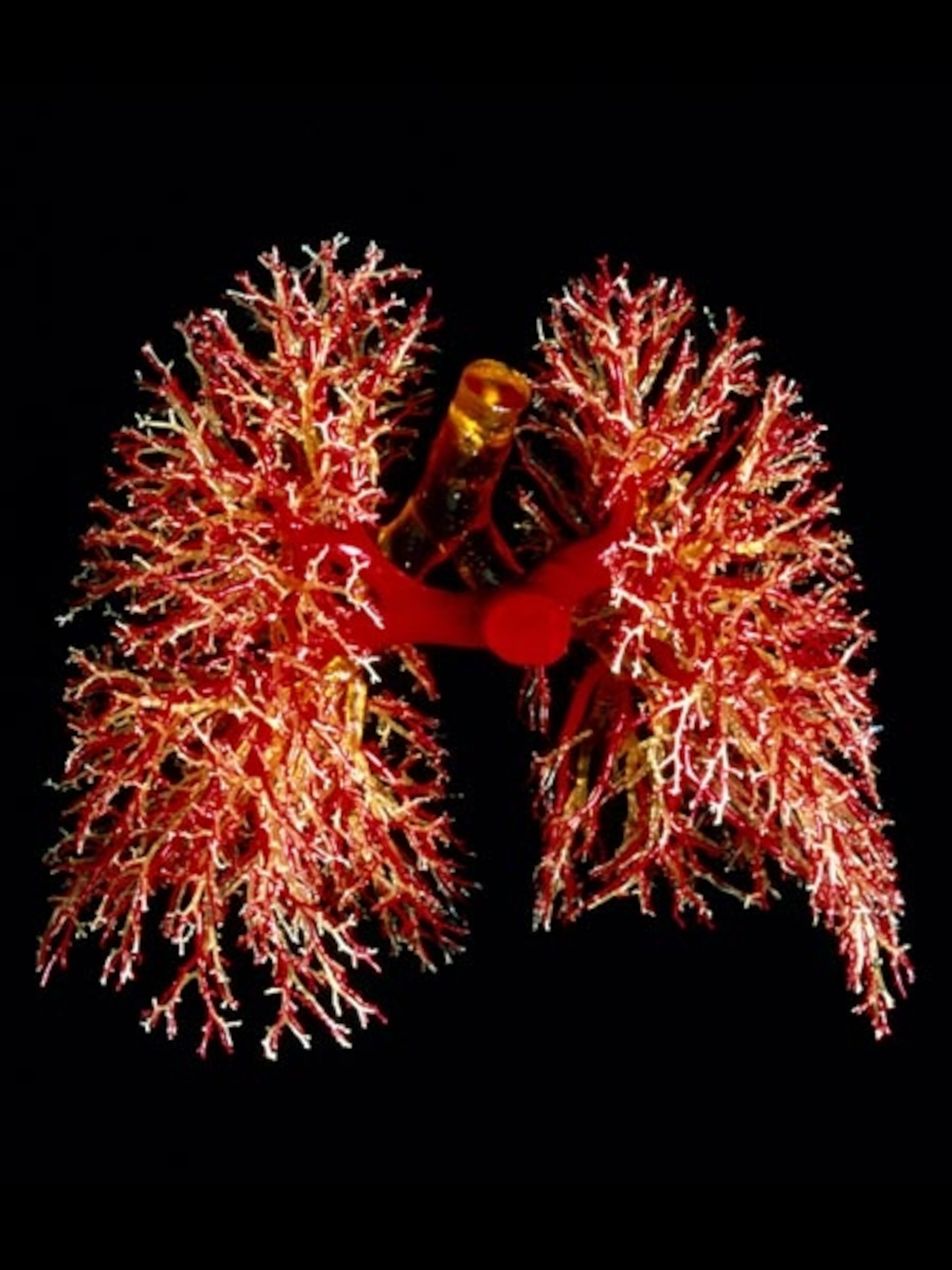A resin cast of lungs