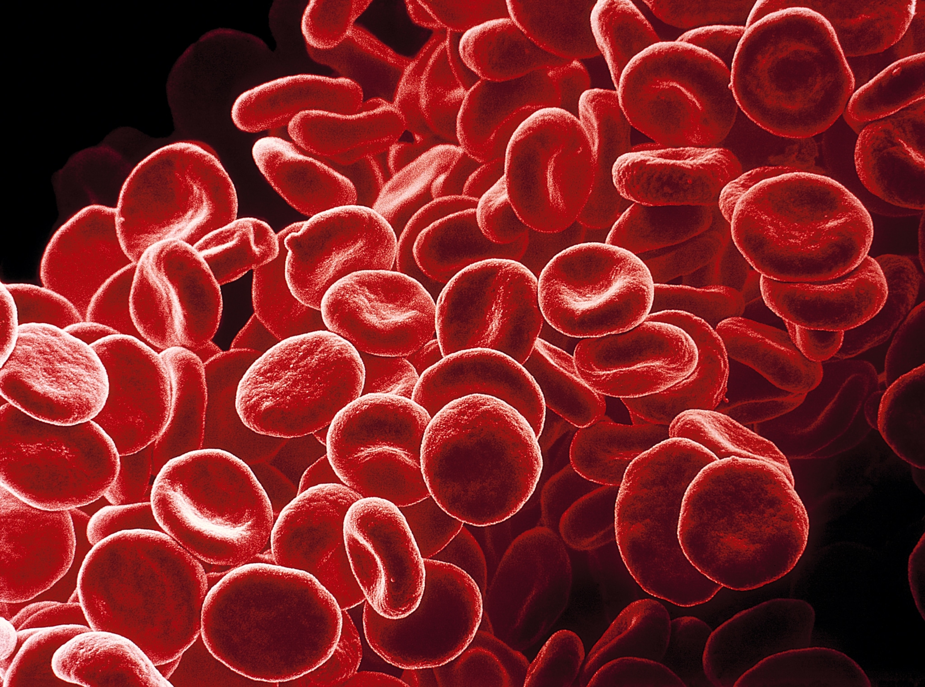 Hundreds of red blood cells, magnified via scanning electron microscopy; revealing the concave-disc shape of these cells.