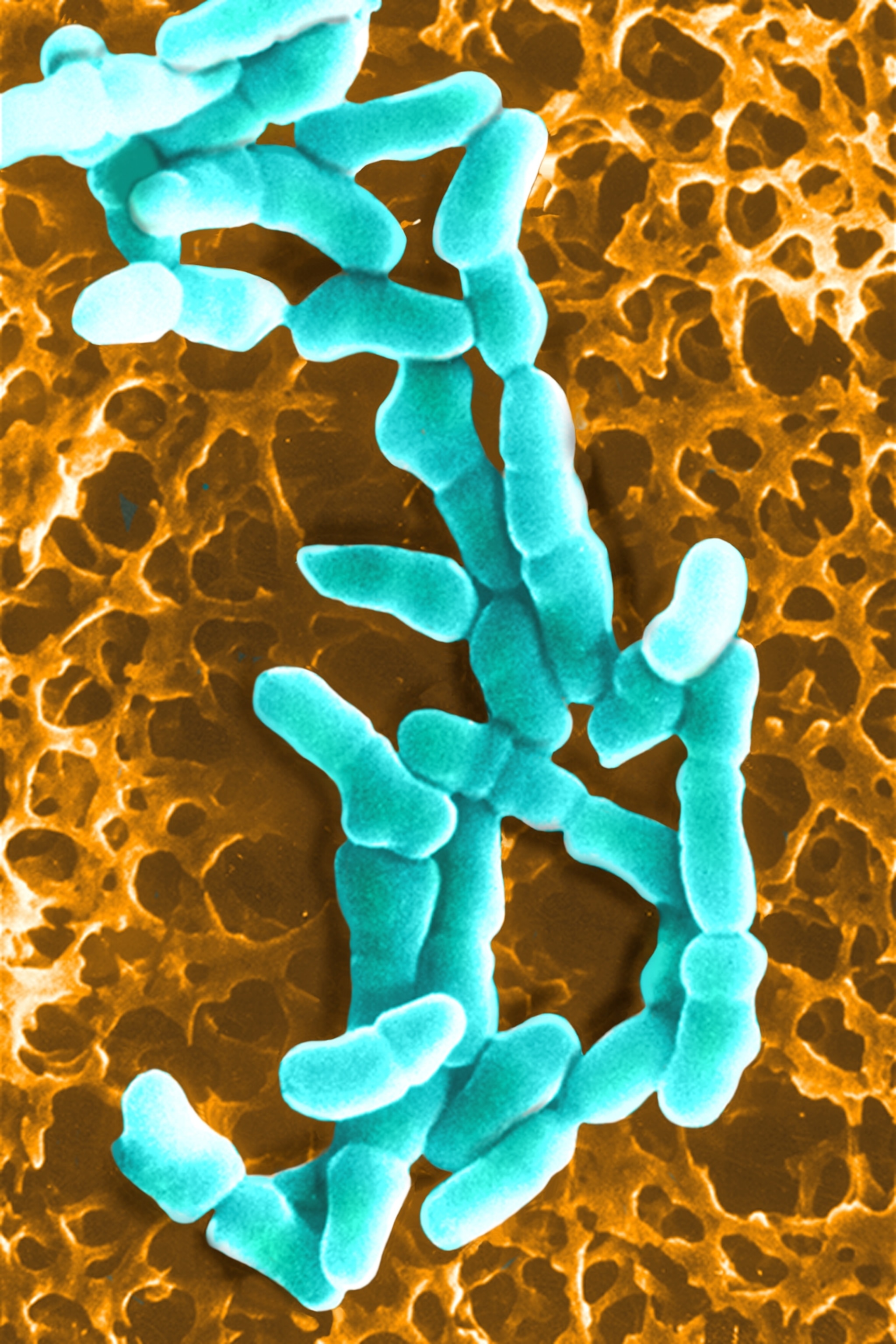 A colorized micrographic view of a group of rod-shaped bacteria, which are appear blue and often interconnect at their distal and proximal ends.