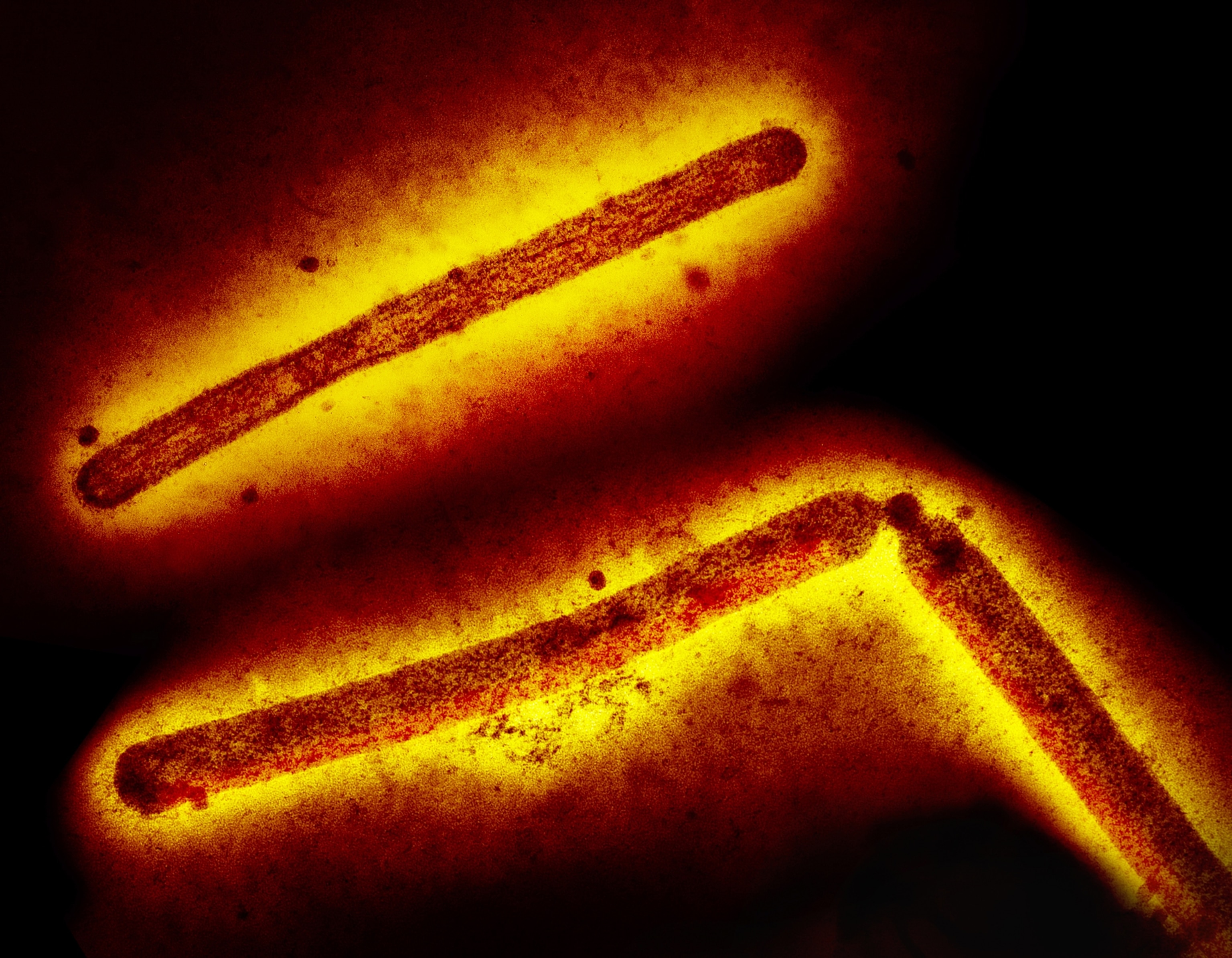 A colorized microscopic view of H5N1 bird flu particles, which appear here as red rods encapsulated by a yellow glow.