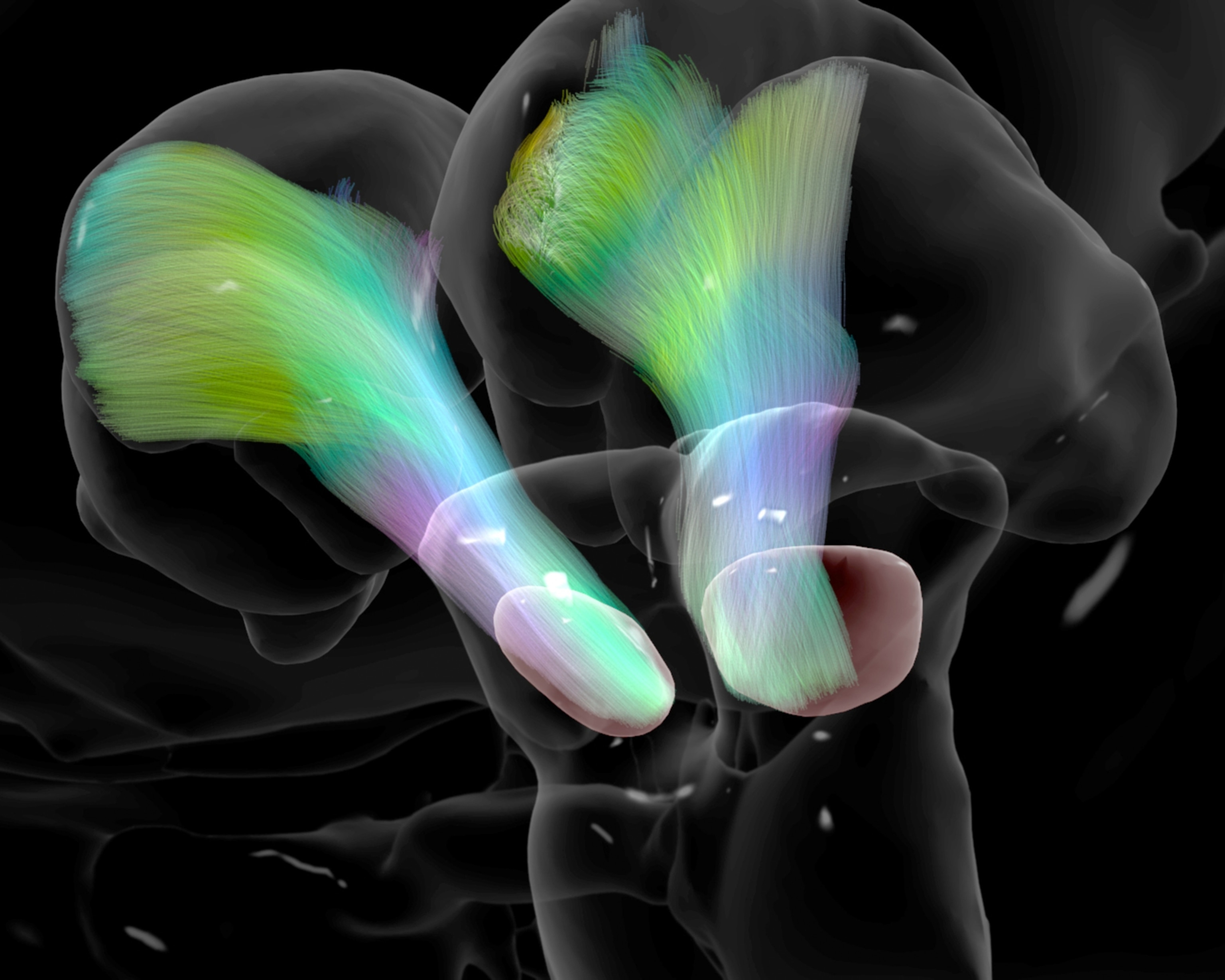 A computerized brain scan showing the nerve fibers of the substantia nigra brain region.