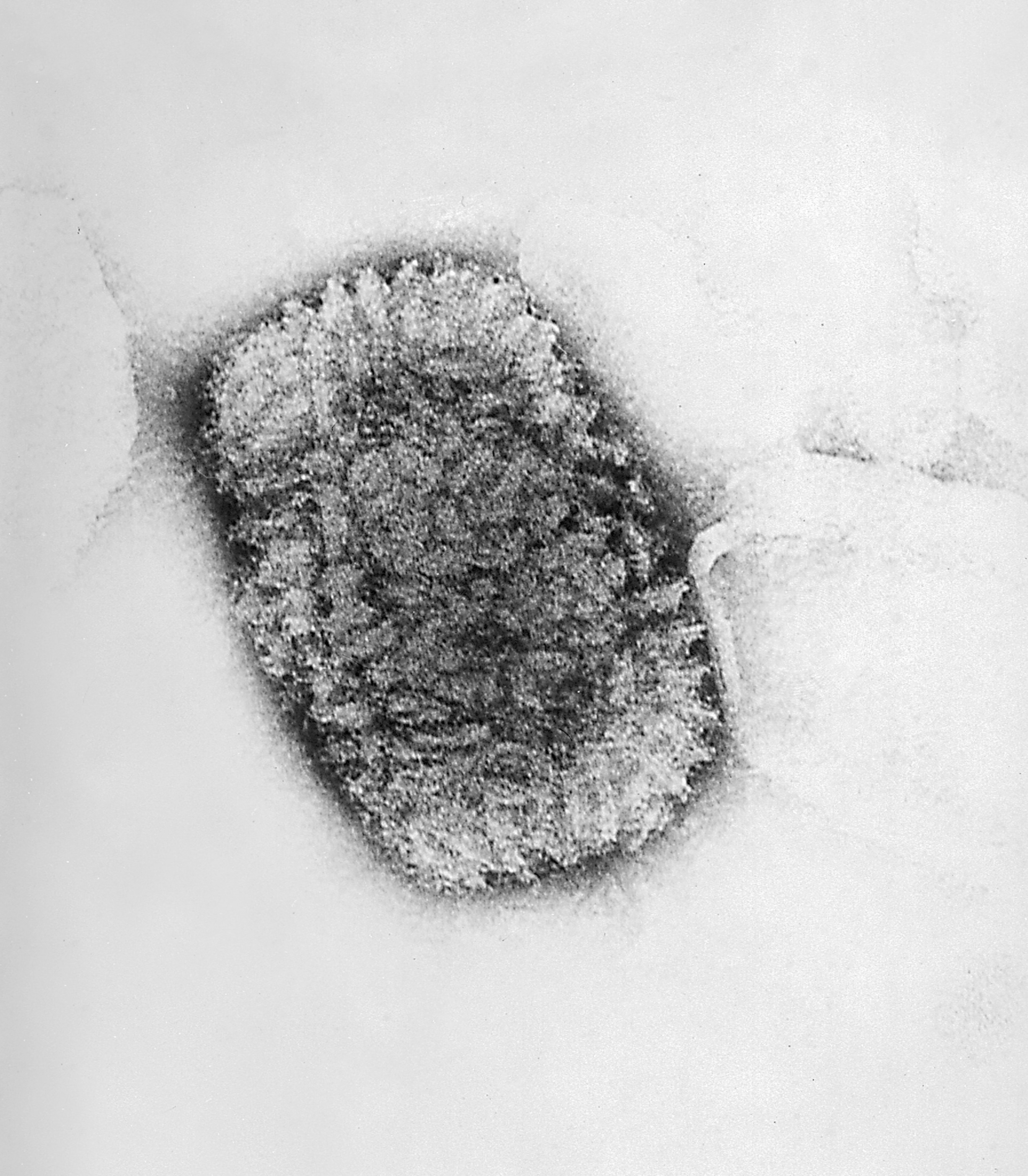 Picture of a Vaccinia virus as imaged via electron micrograph.
