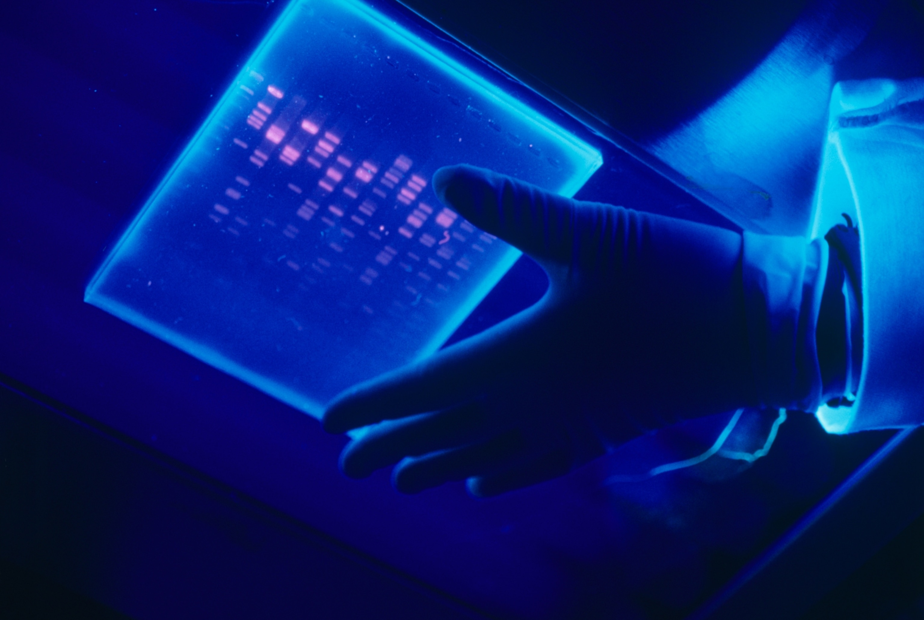 DNA sequencing as seen via gel electrophoresis; lit under ultraviolet light, pink bands of varying thickness are seen across the gel.