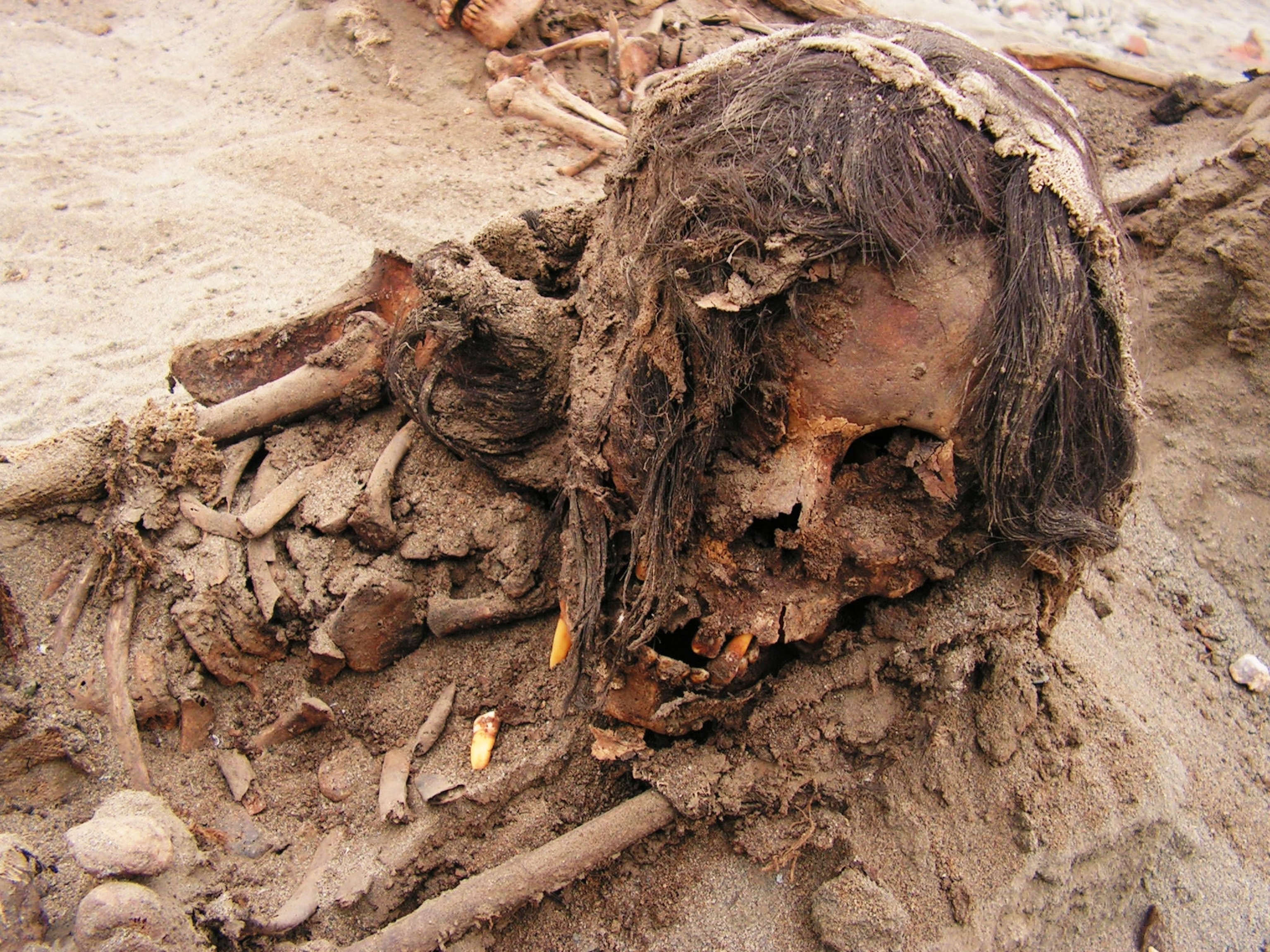 child skull with well preserved thick black hair and teeth.