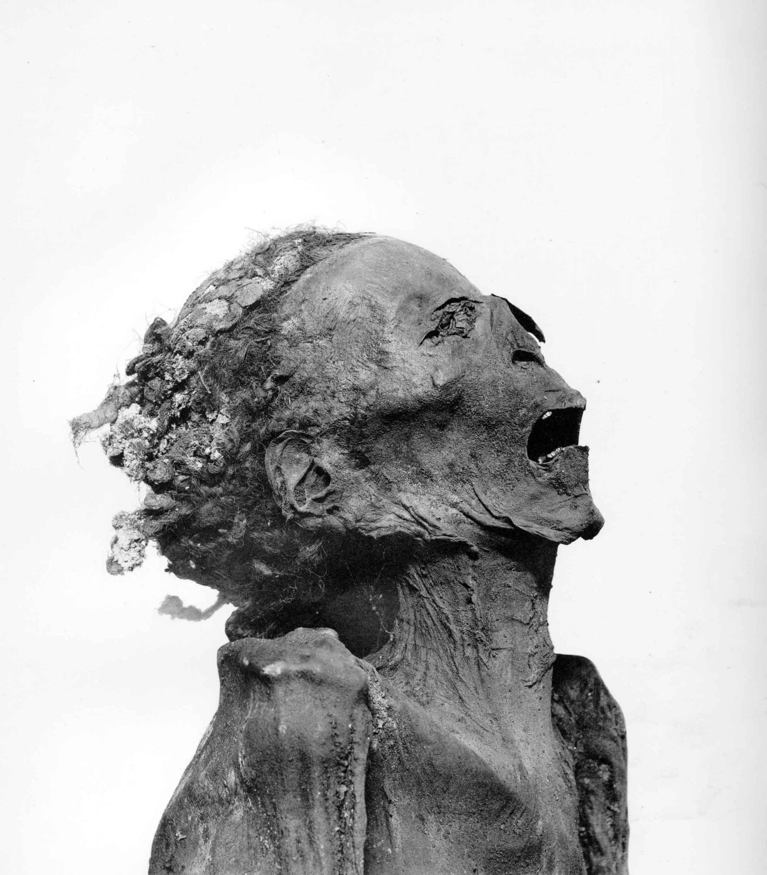 A black and white photograph of Prince Pentawer's mummy head, neck, and chest from the Twentieth Dynasty of Egypt shows his frozen, screaming-like expression.