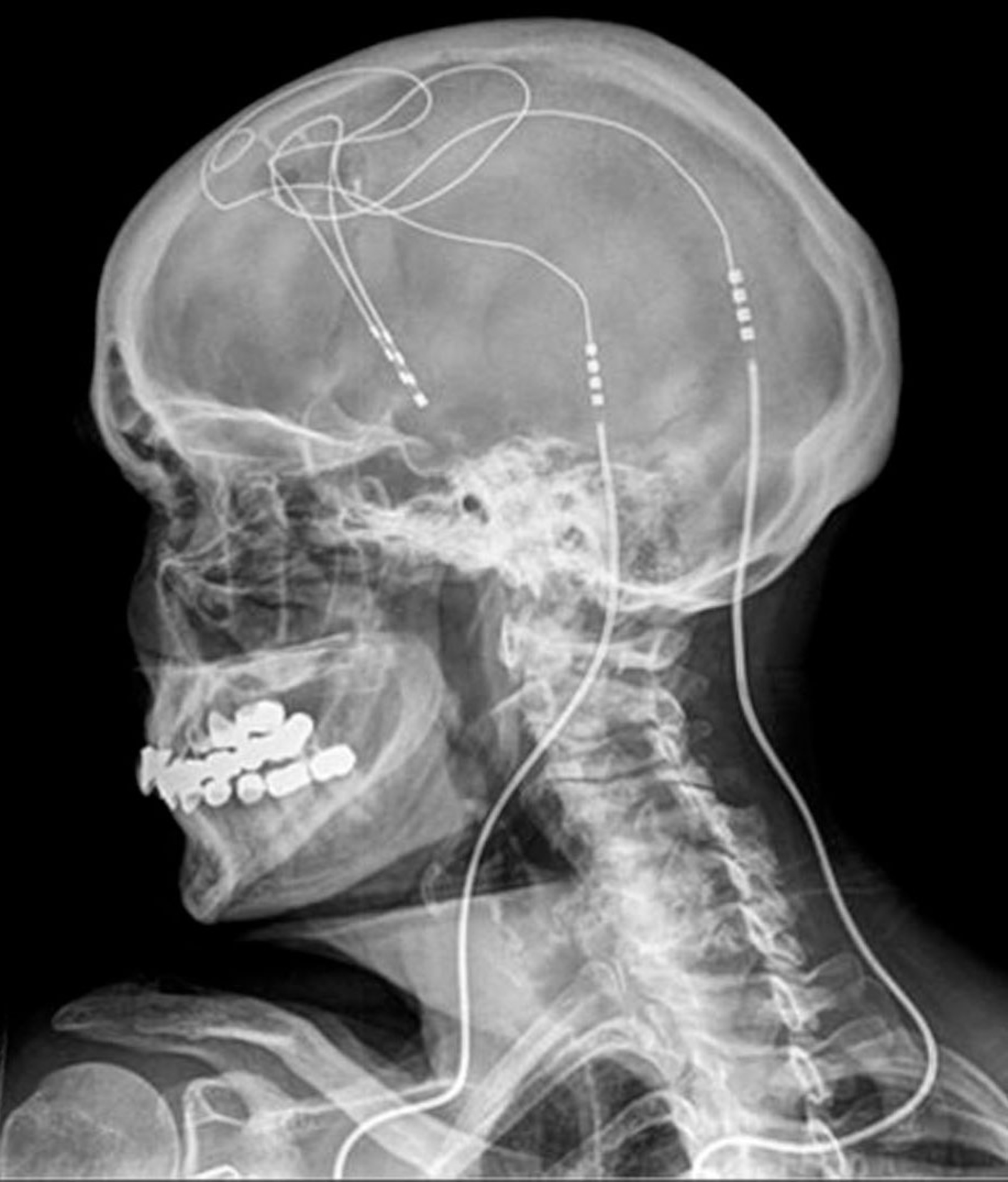 a X-Ray
