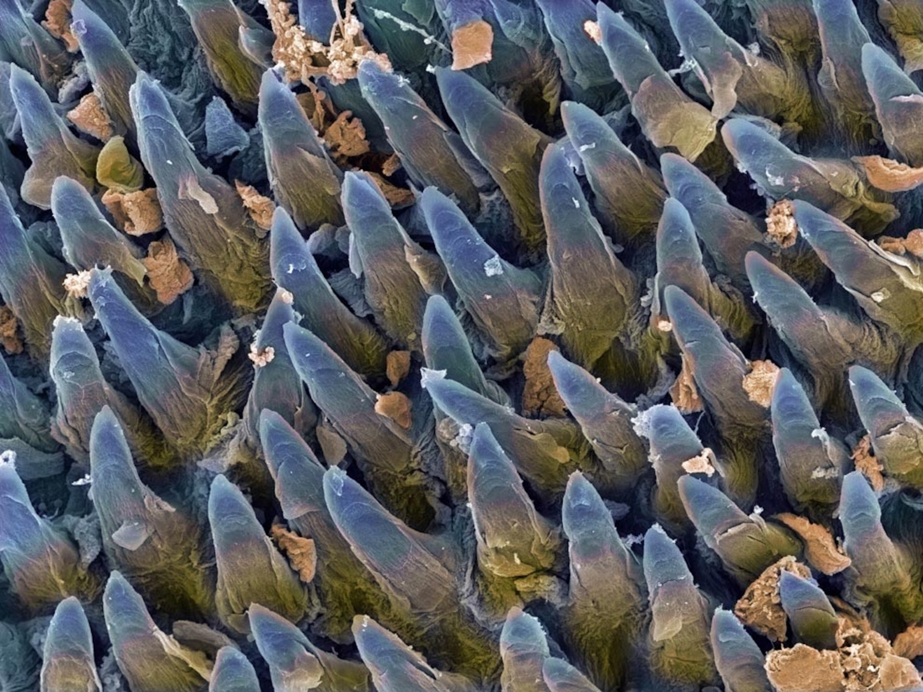 Tongue papillae