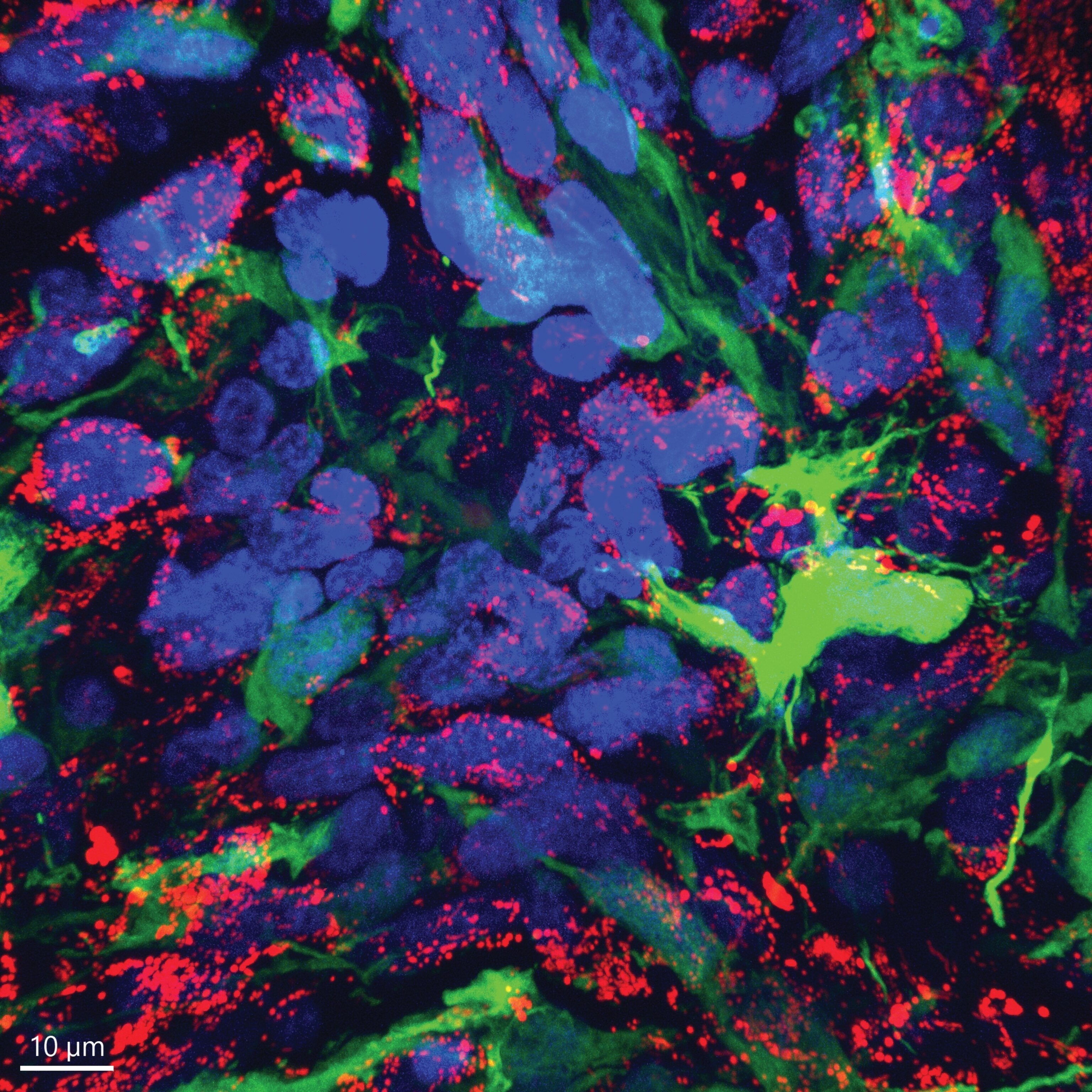 A colorized microscopic image of green and blue smudges and swirls and red dots.