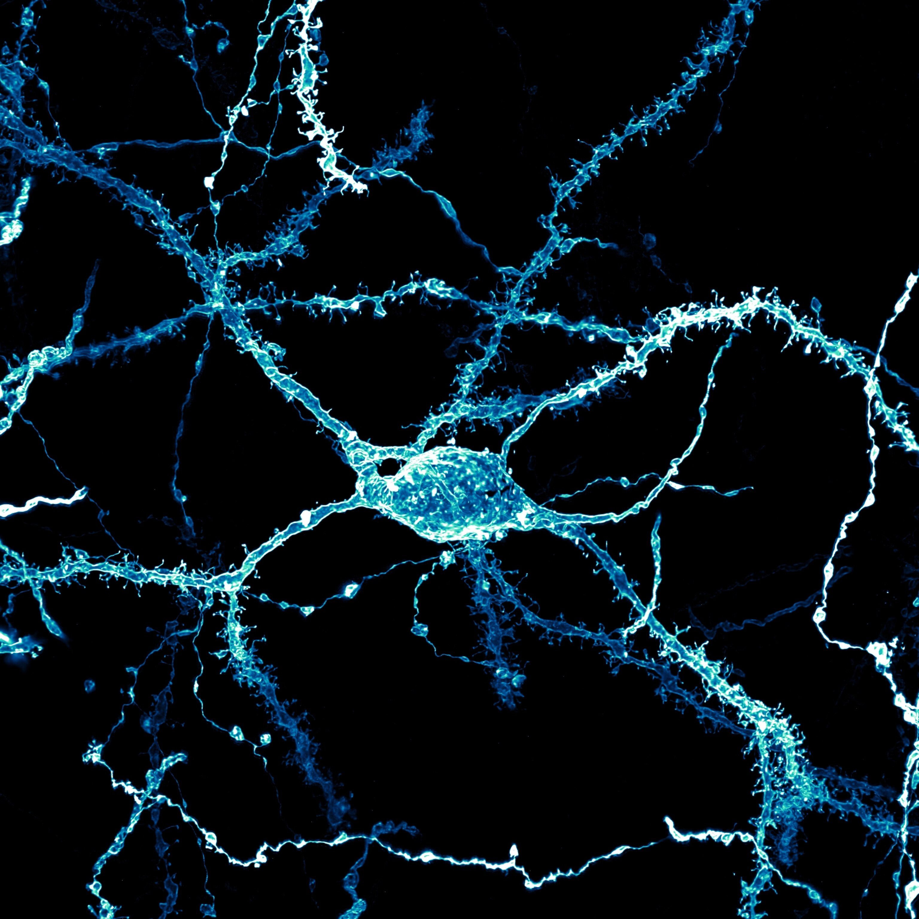 A singular oval-shaped nerve body from which several jagged dendritic spines spill across the frame.
