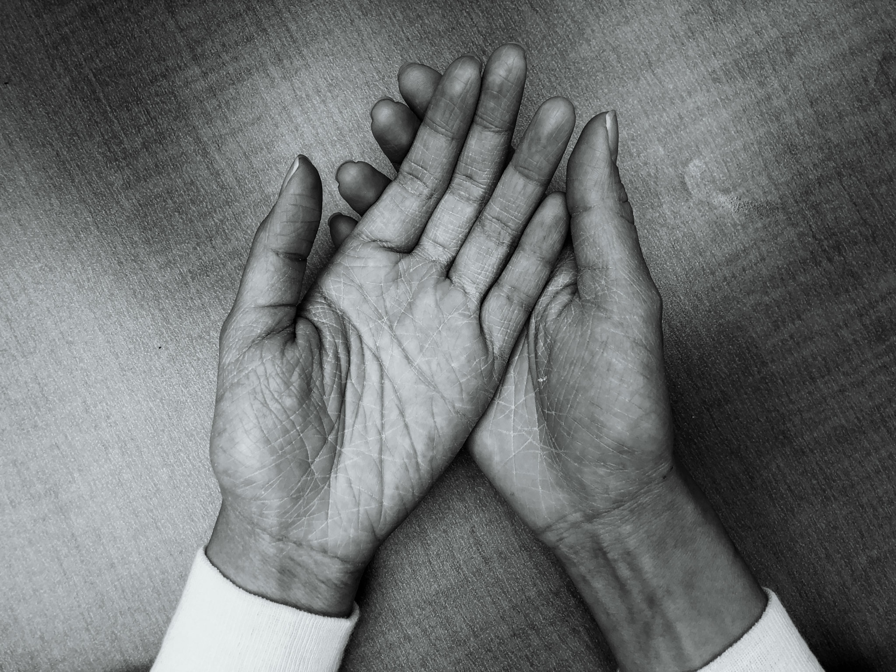 a woman's hands chapped from using sanitizer