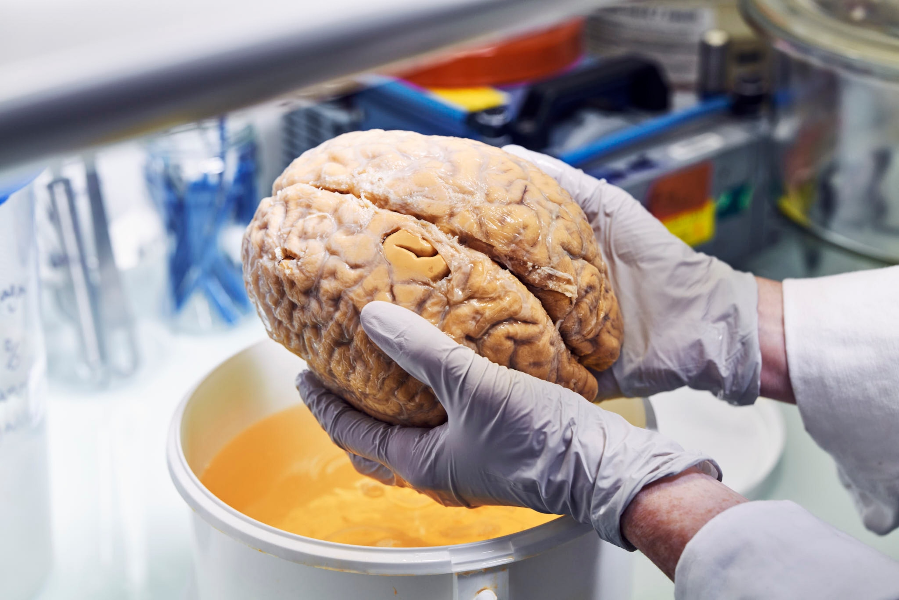 A brain conserved in the biomedical sample preparation lab, where donated human organs are stored for research purposes part of Human Organ ATLAS.