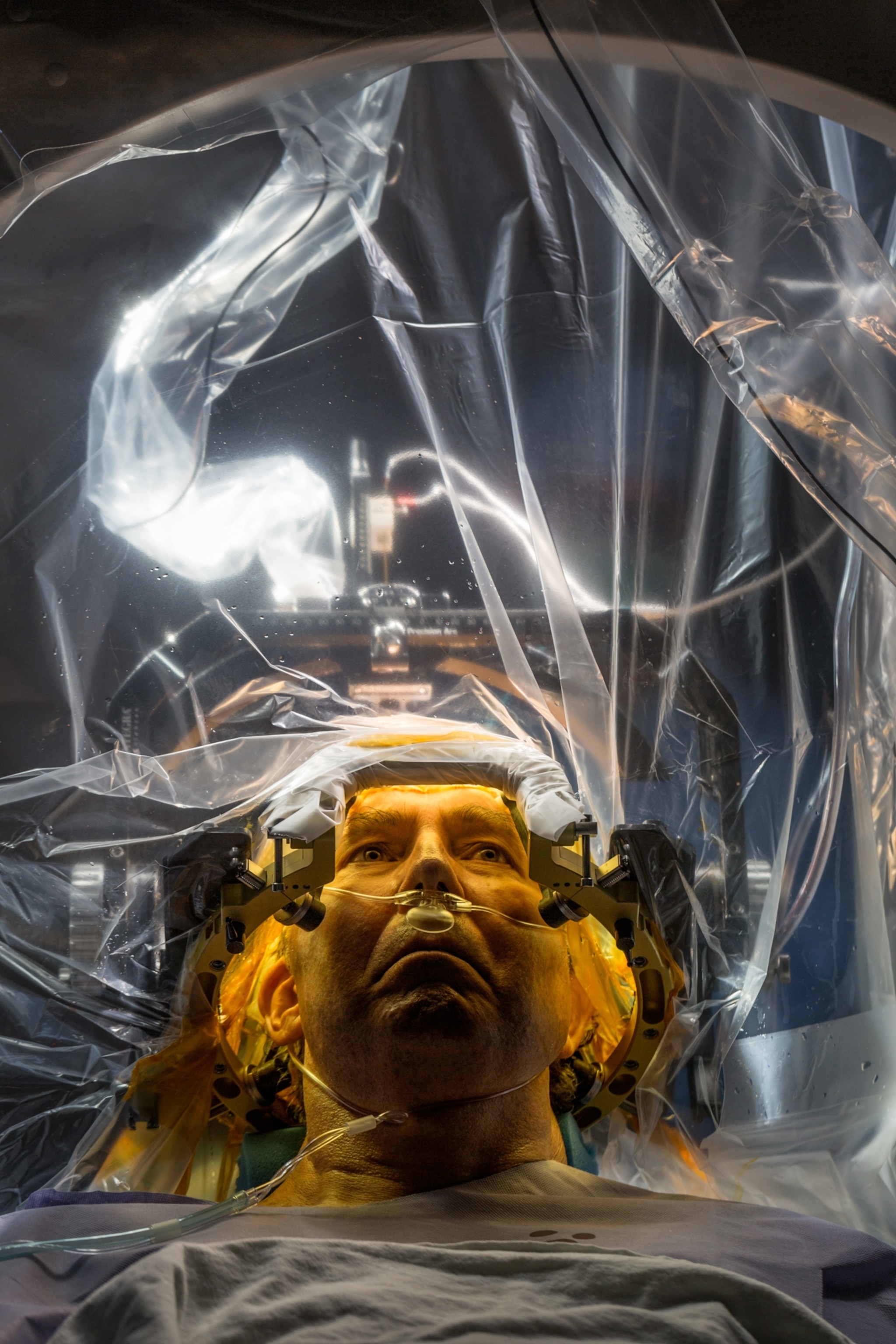 A patient with Parkinson's disease seen under clear surgical drapes during a procedure to place electrodes in their brain. The patient is awake with eyes open, their face lit by yellow light, which contrasts with the bright white surgical lights in the background.