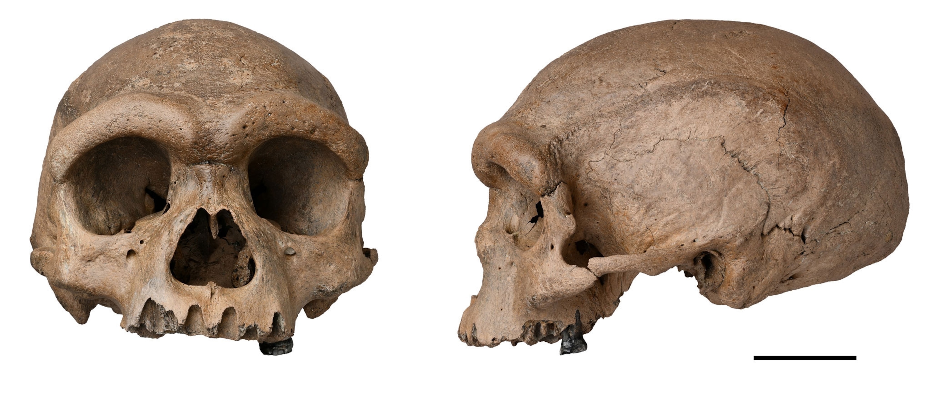 Harbin cranium