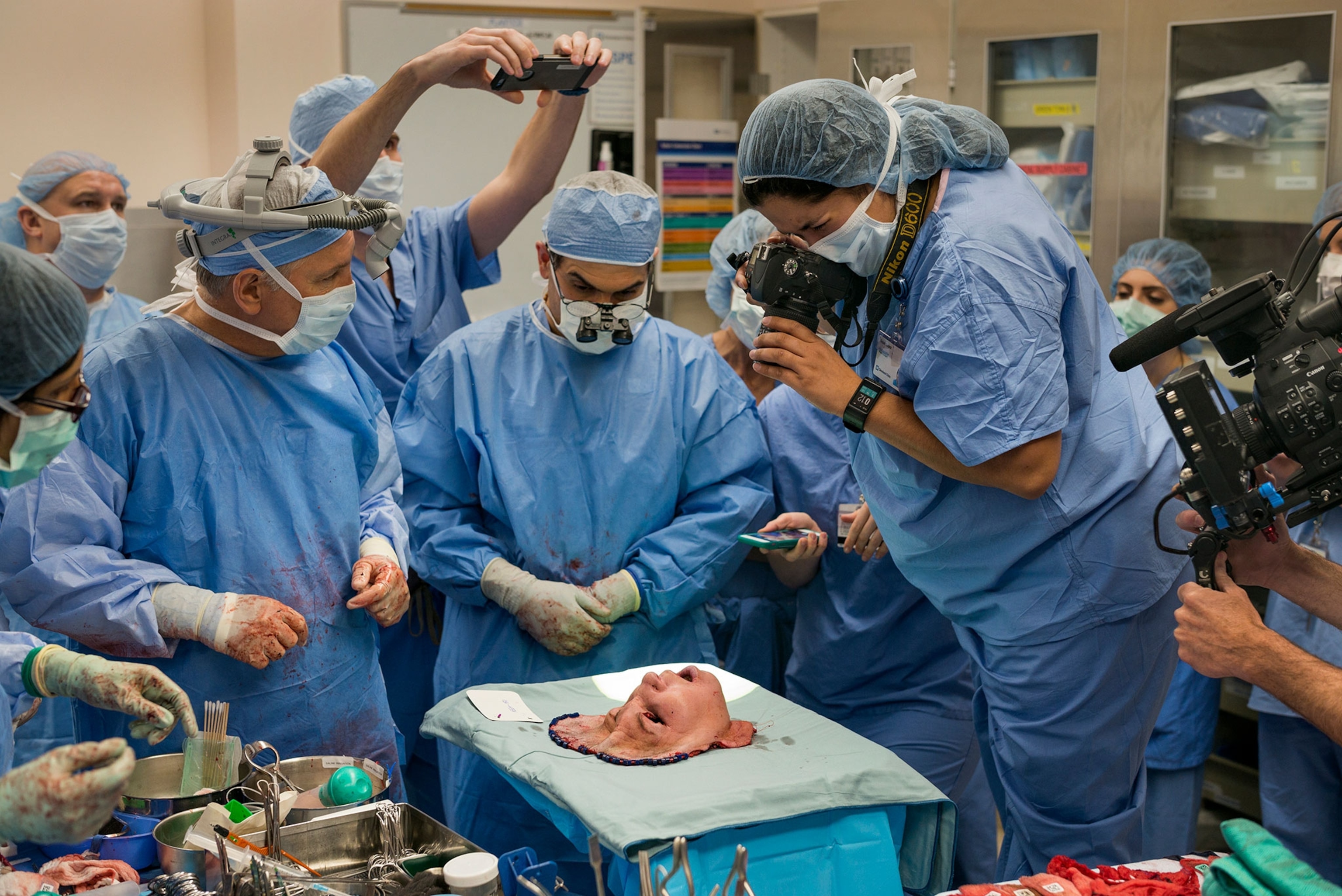 Surgeons in blue scrubs observe and take pictures of a face on a tray